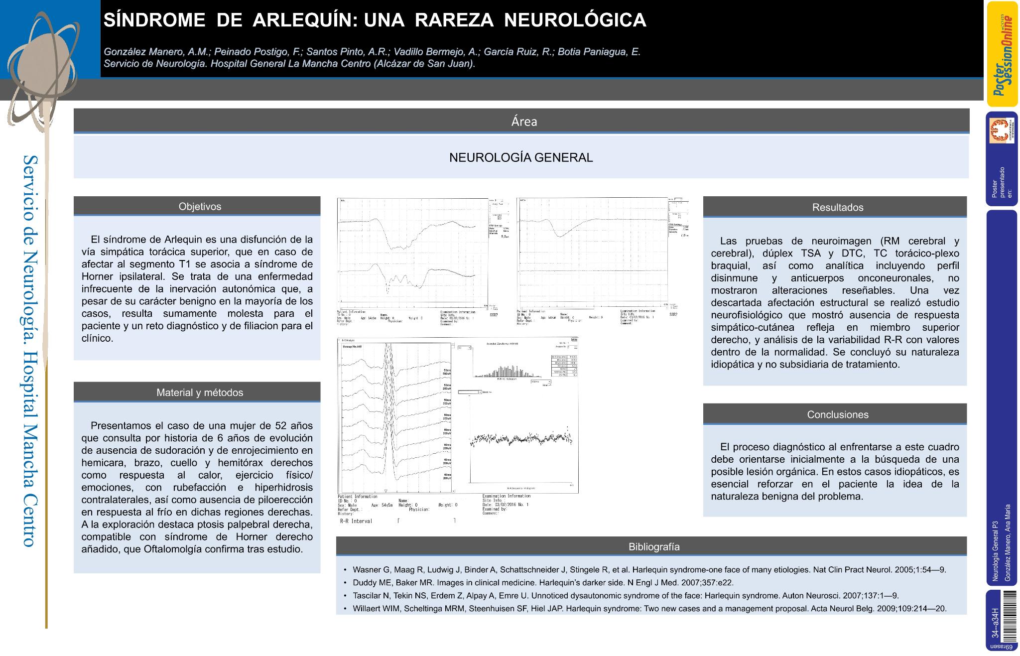 Síndrome de Arlequín: una rareza neurológica