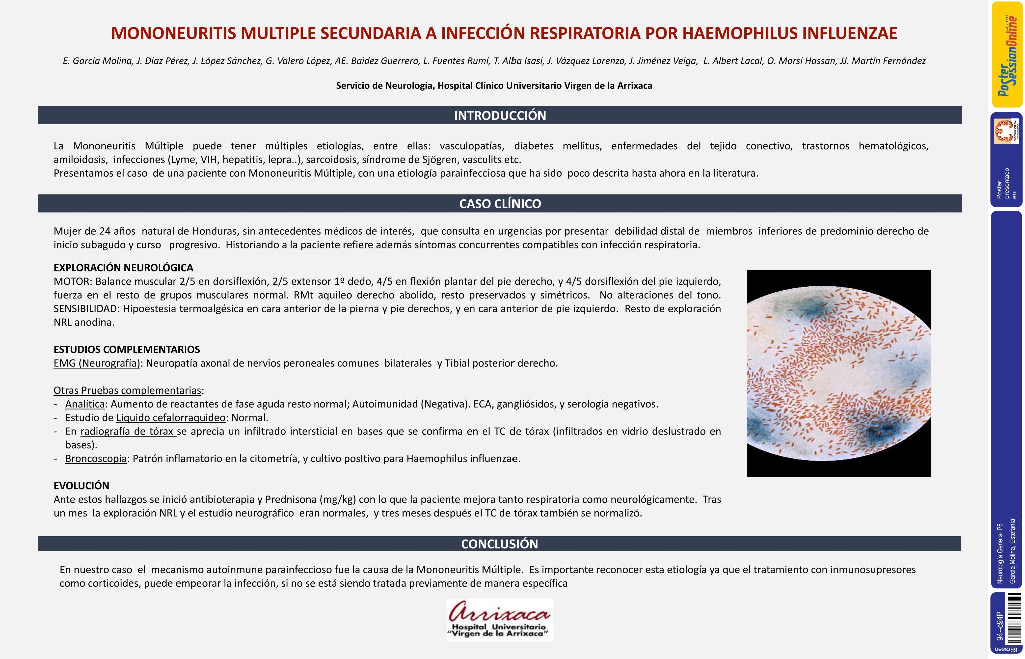 Mononeuritis múltiple secundaria a infección respiratoria por Haemophilus influenzae