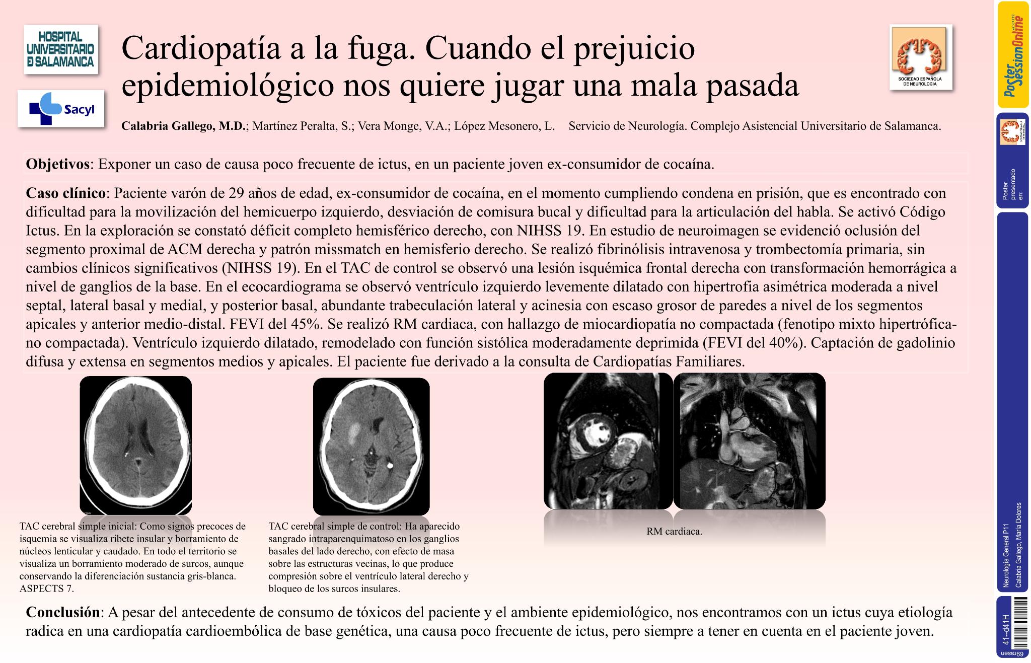 Cardiopatía a la fuga. Cuando el prejuicio epidemiológico nos quiere jugar una mala pasada