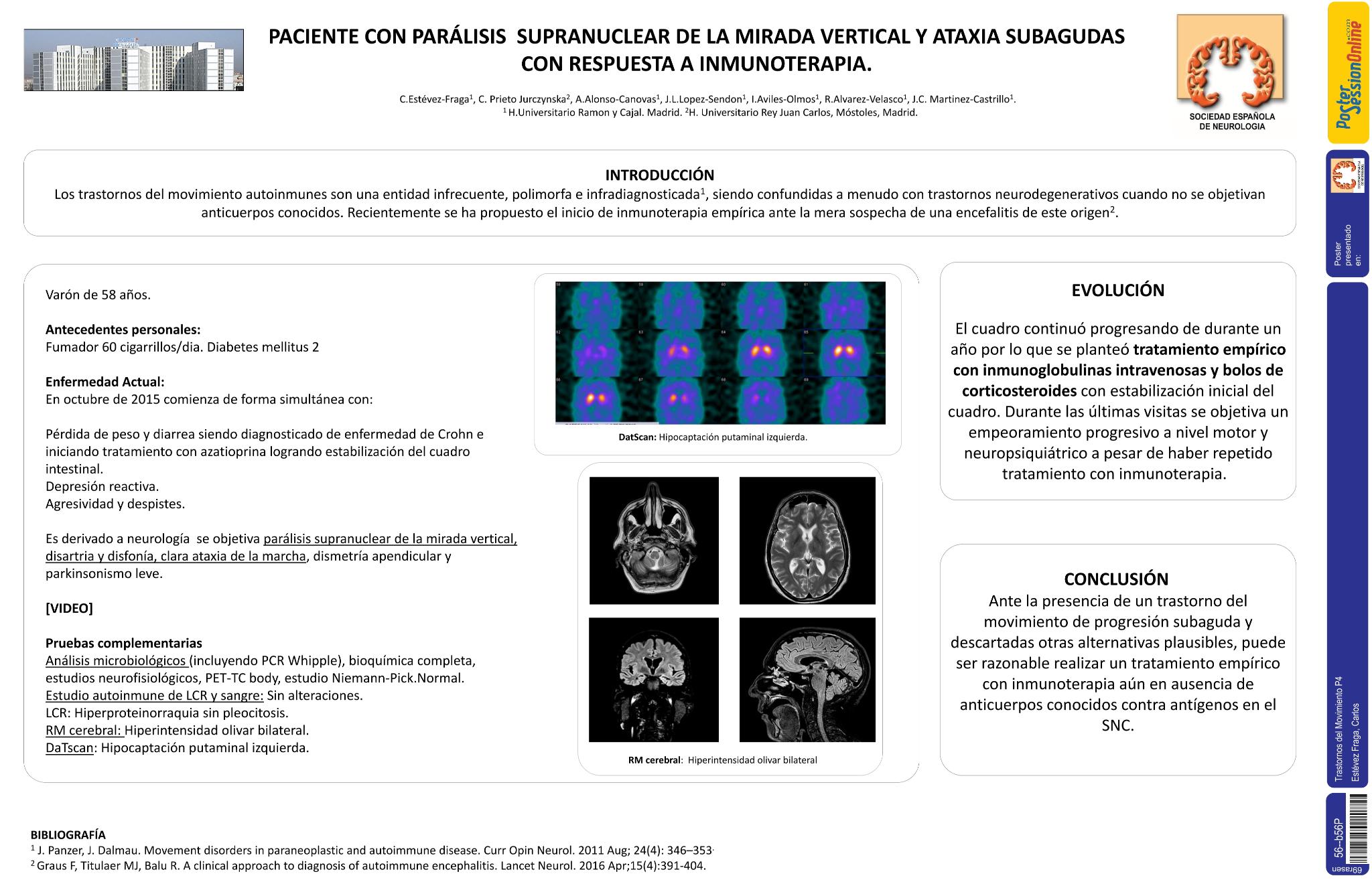 Paciente con parálisis de supranuclear de la mirada vertical y ataxia subagudas con respuesta a inmunoteraia