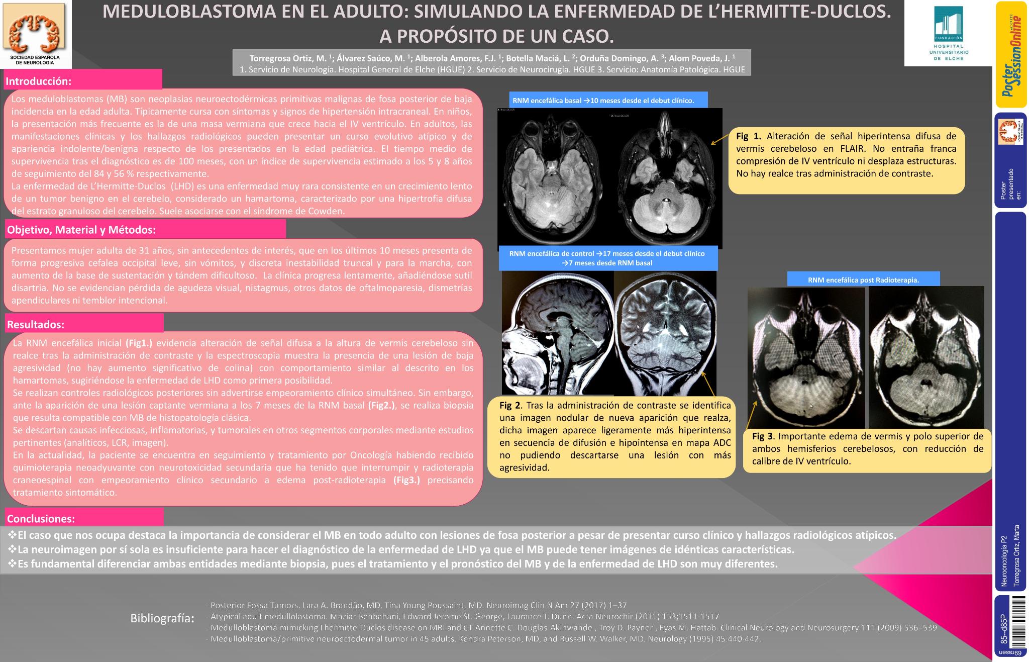 Meduloblastoma en el adulto: simulando la enfermedad de Lhermitte-Duclos. A propósito de un caso