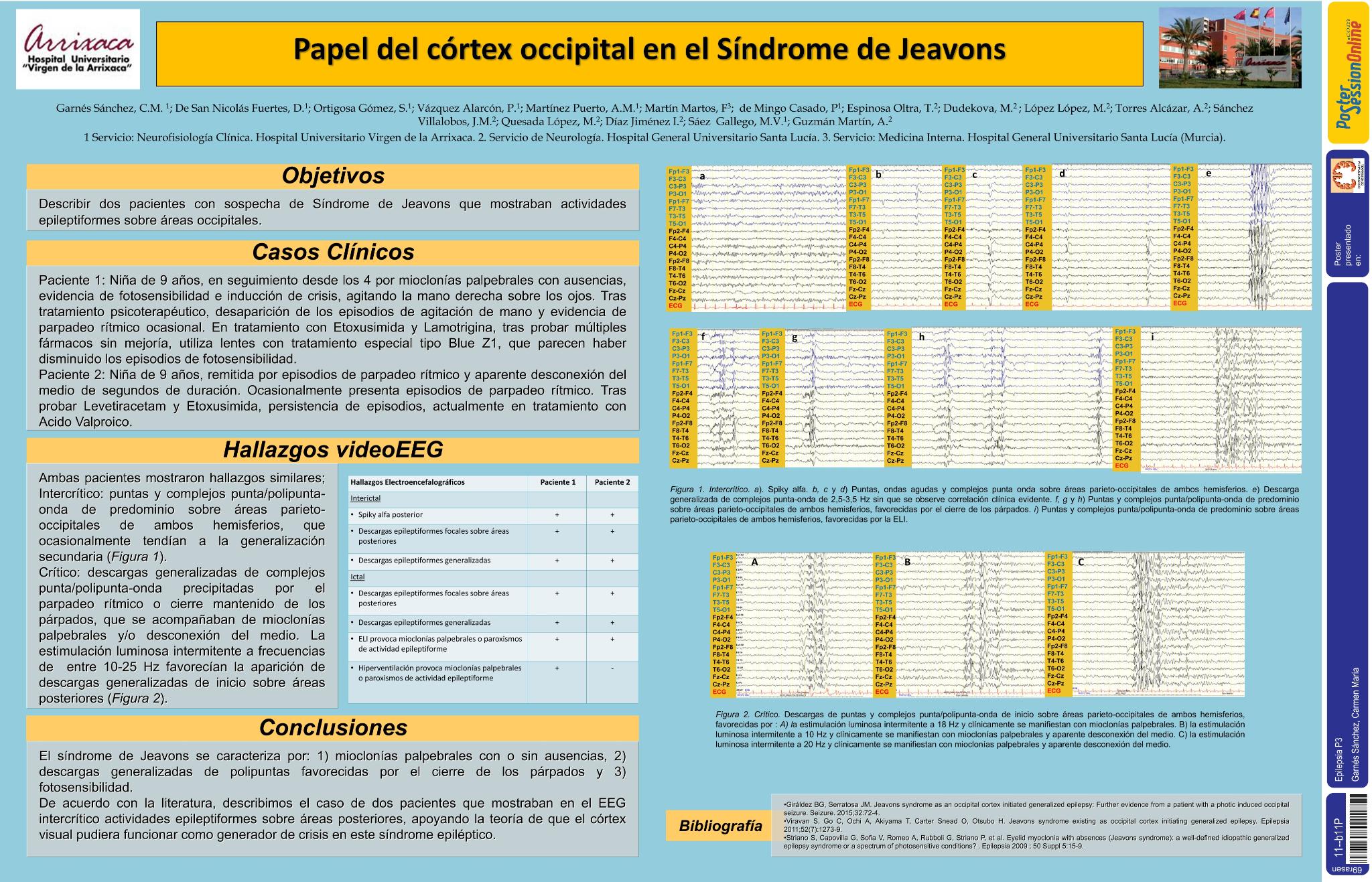 Papel del córtex occipital en el Síndrome de Jeavons