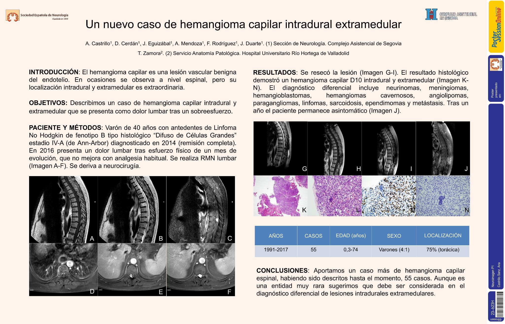 Un nuevo caso de hemangioma medular intradural extramedular