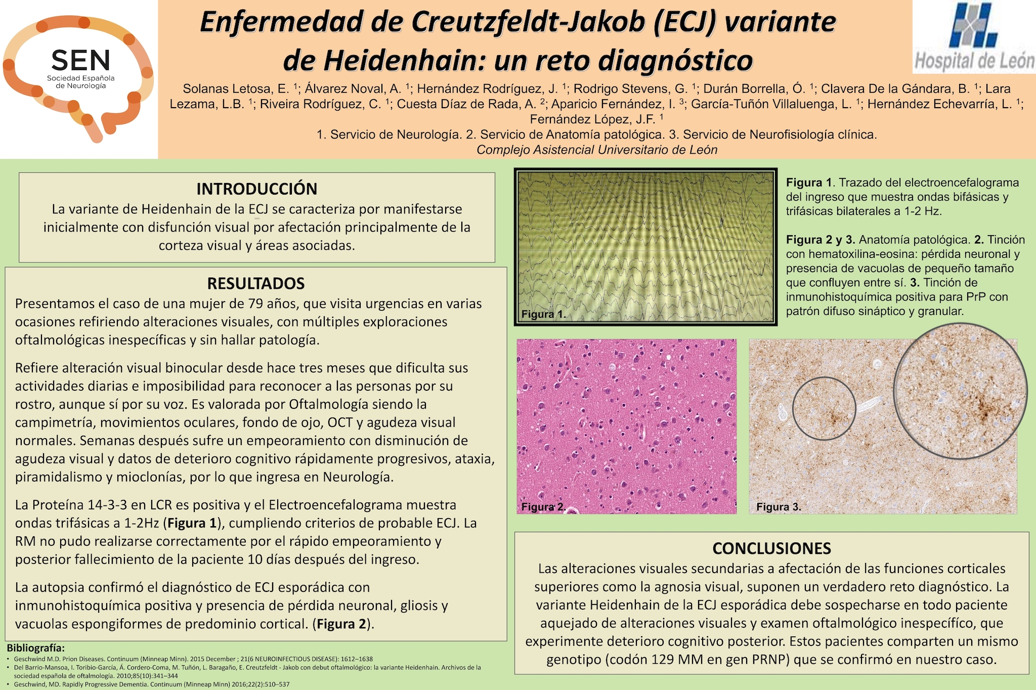 Enfermedad de Creutzfeldt-Jakob (ECJ) variante de Heidenhain: un reto diagnóstico