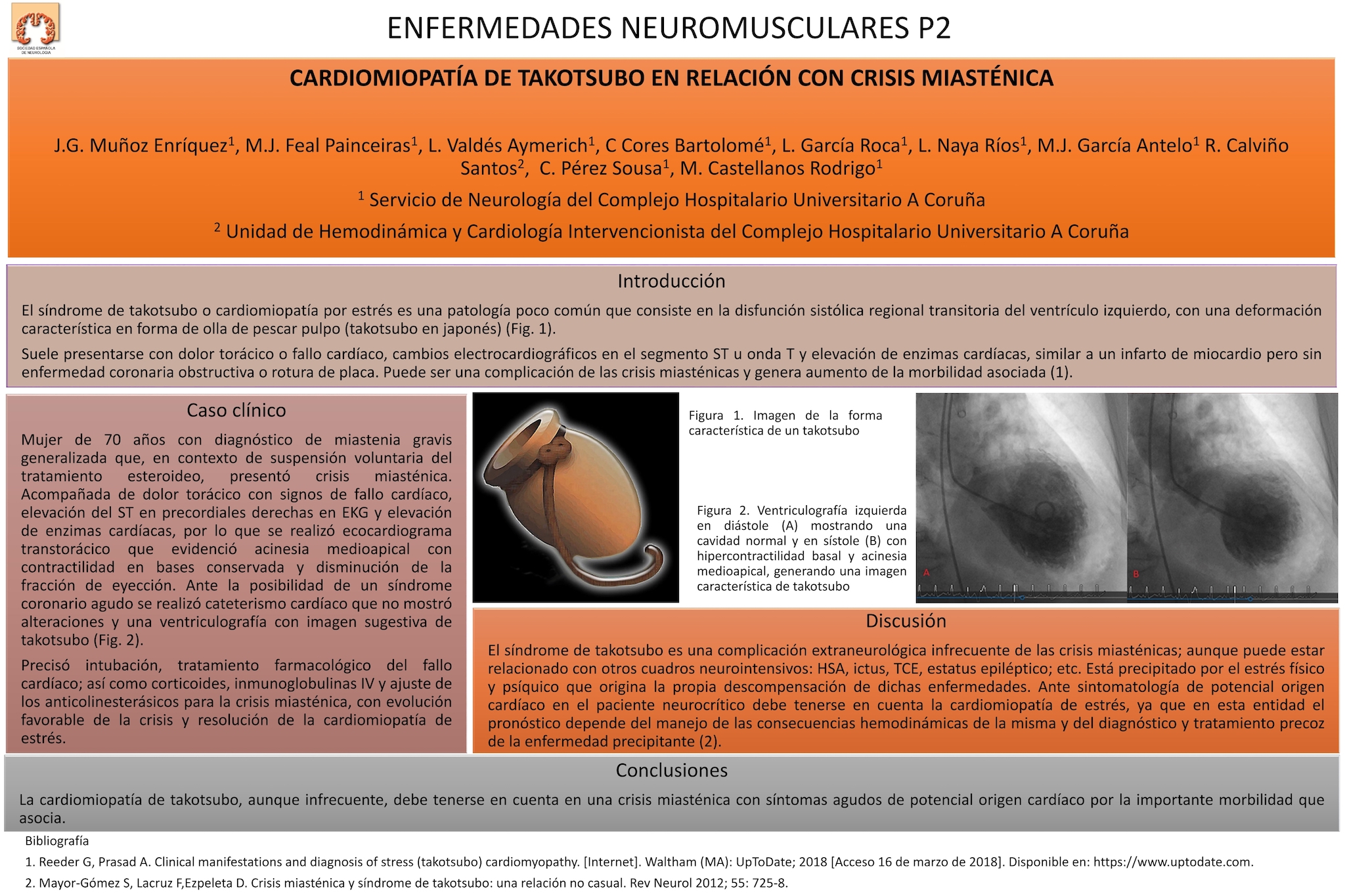 Cardiomiopatía de takotsubo en relación con crisis miasténica