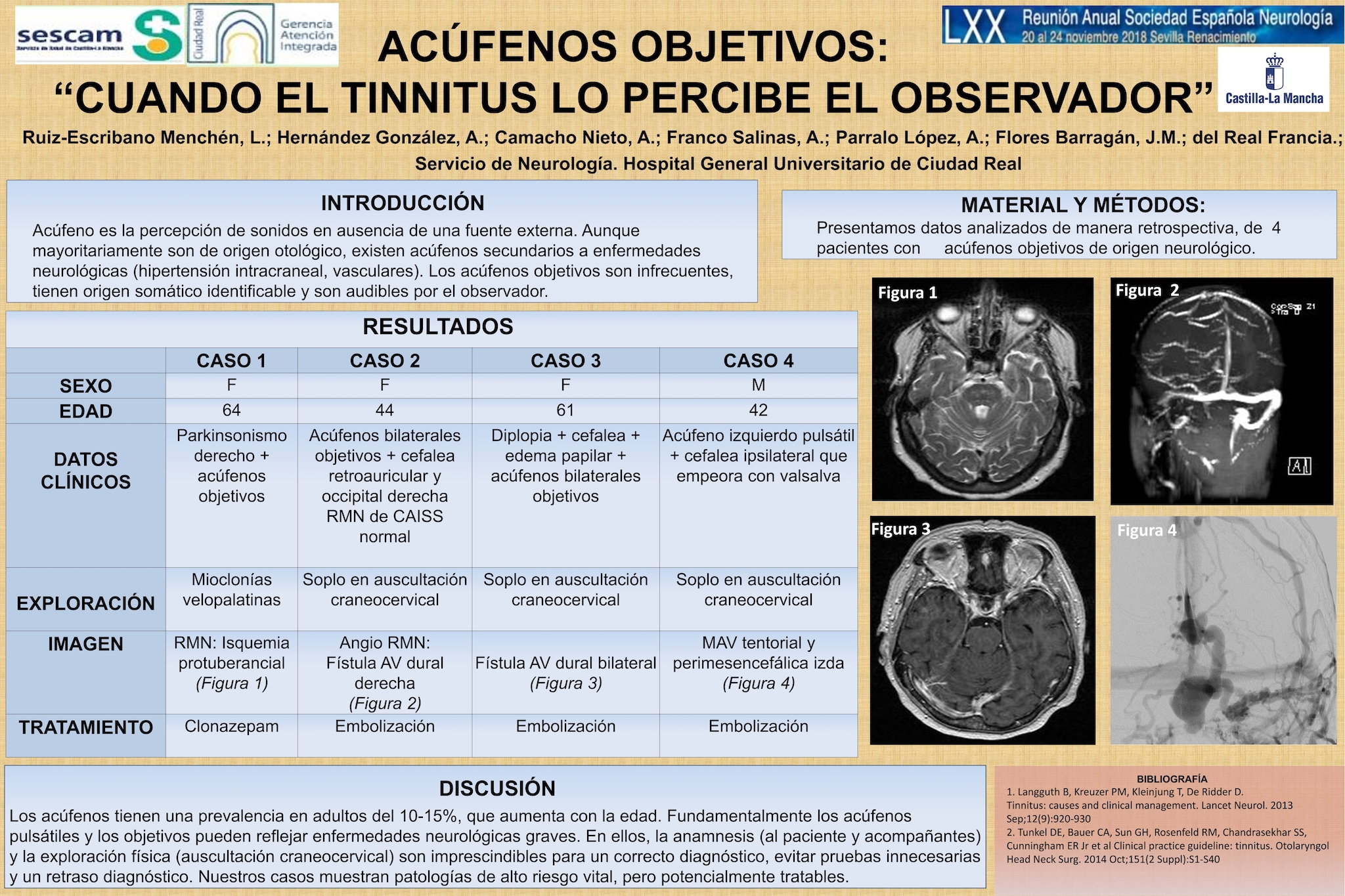 Acúfenos objetivos: “cuando el tinnitus lo percibe el observador”
