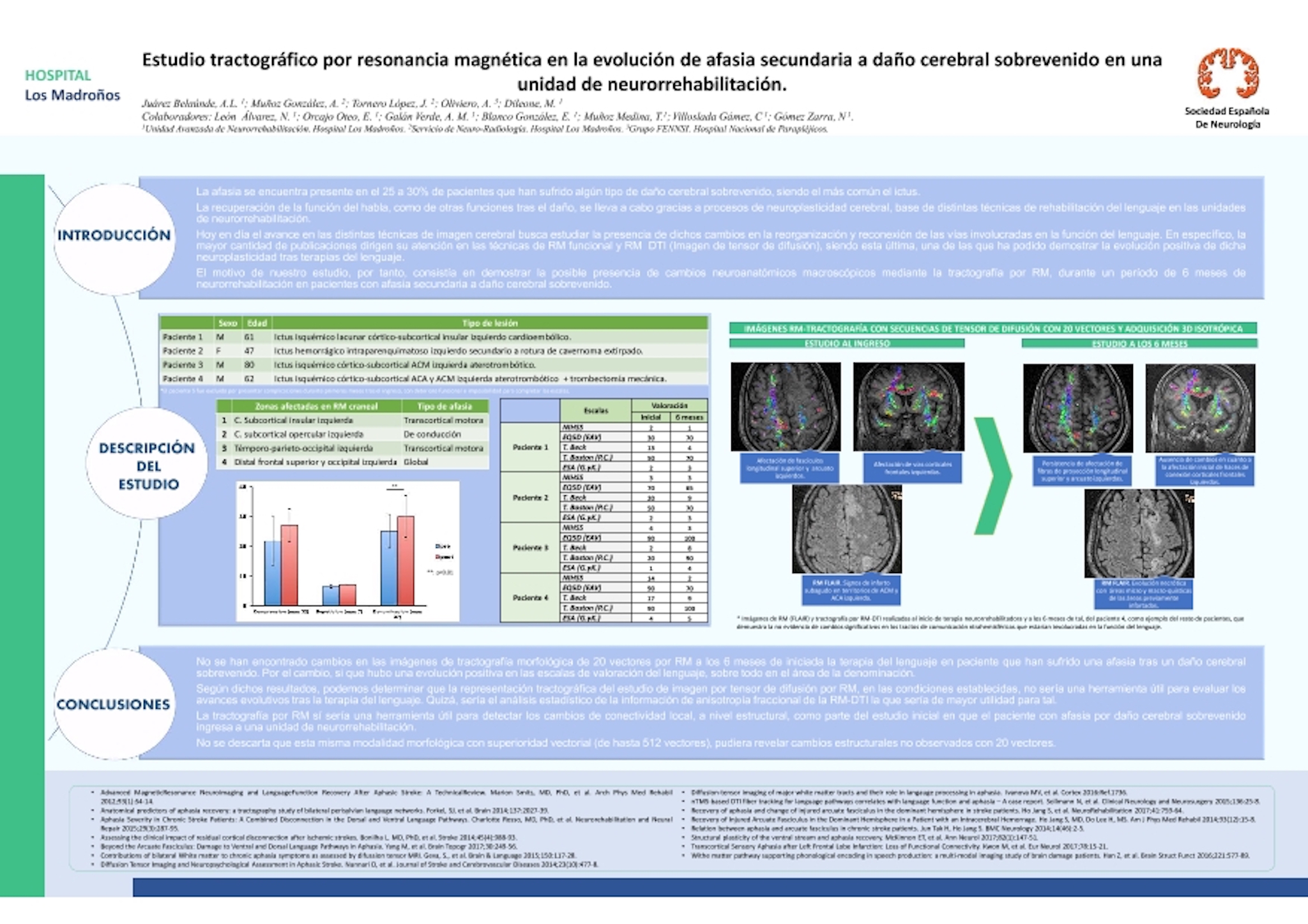 Estudio tractográfico por resonancia magnética en la evolución de afasia secundaria a daño cerebral sobrevenido en una unidad de neurorrehabilitación
