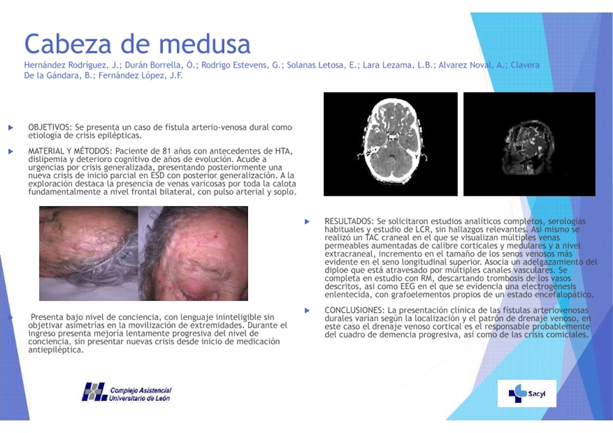 Cabeza de medusa