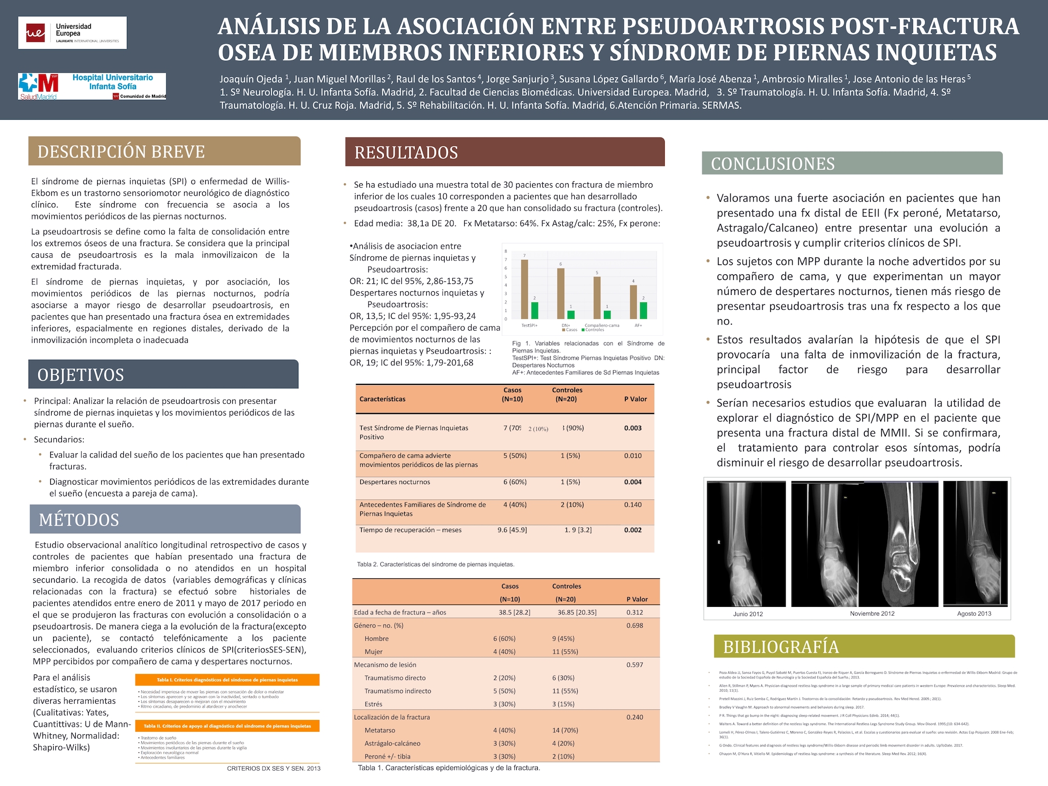 Análisis de la asociación entre pseudoartrosis post-fractura ósea de miembros inferiores y Síndrome de Piernas Inquietas