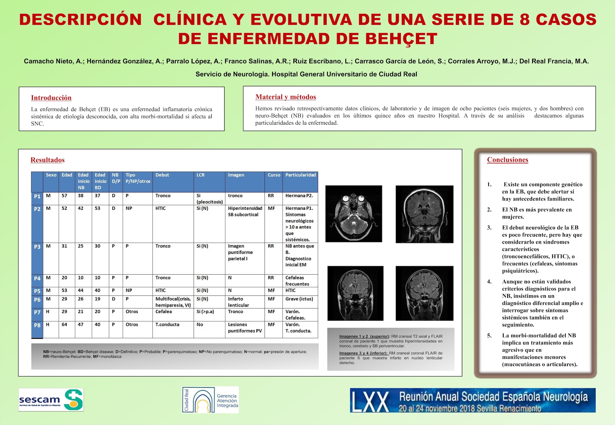 Descripción clínica y evolutiva de una serie de 8 casos de enfermedad de Behçet