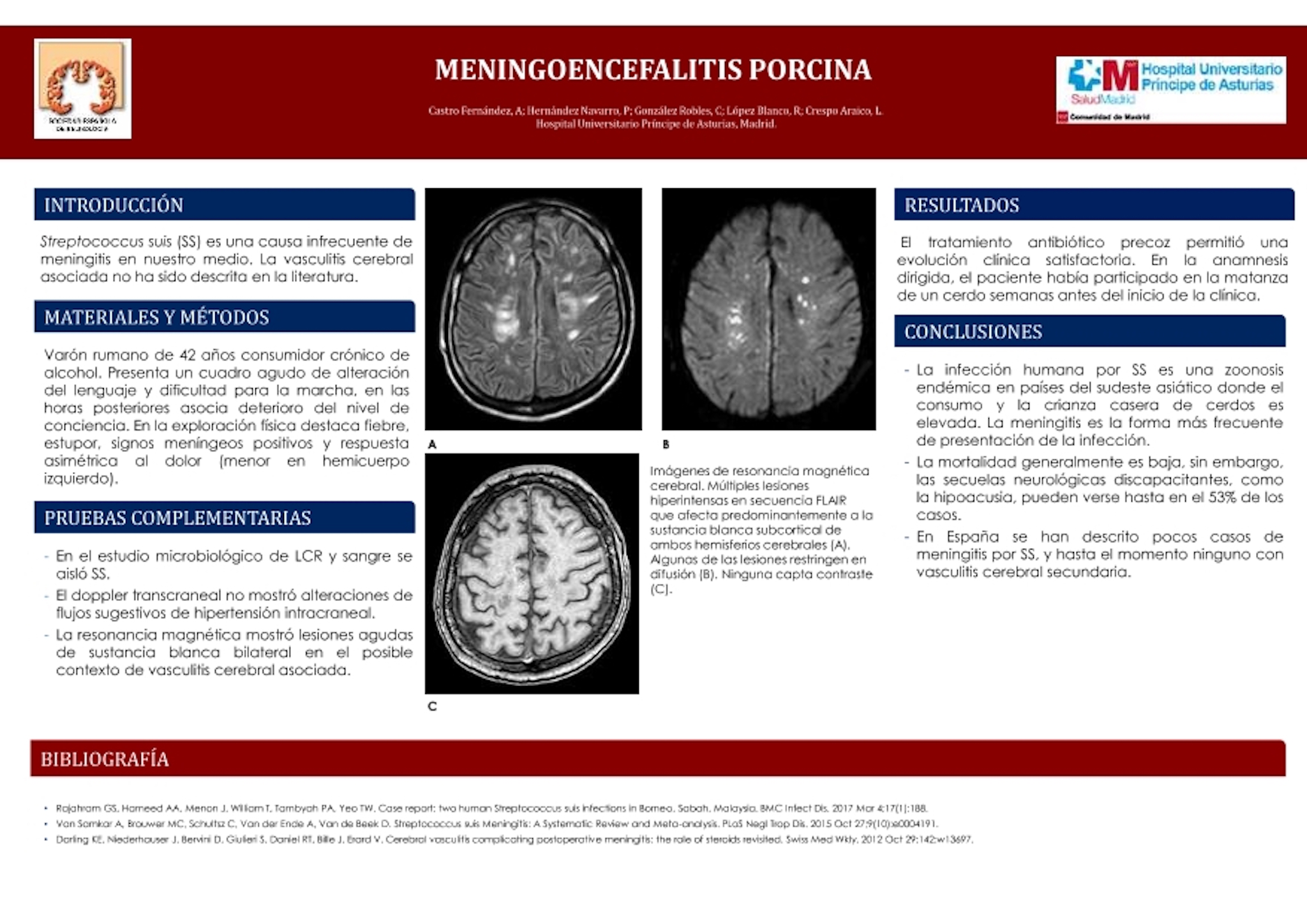Meningoencefalitis porcina