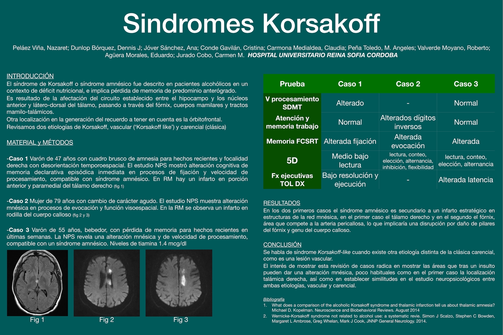 Síndromes Korsakoff