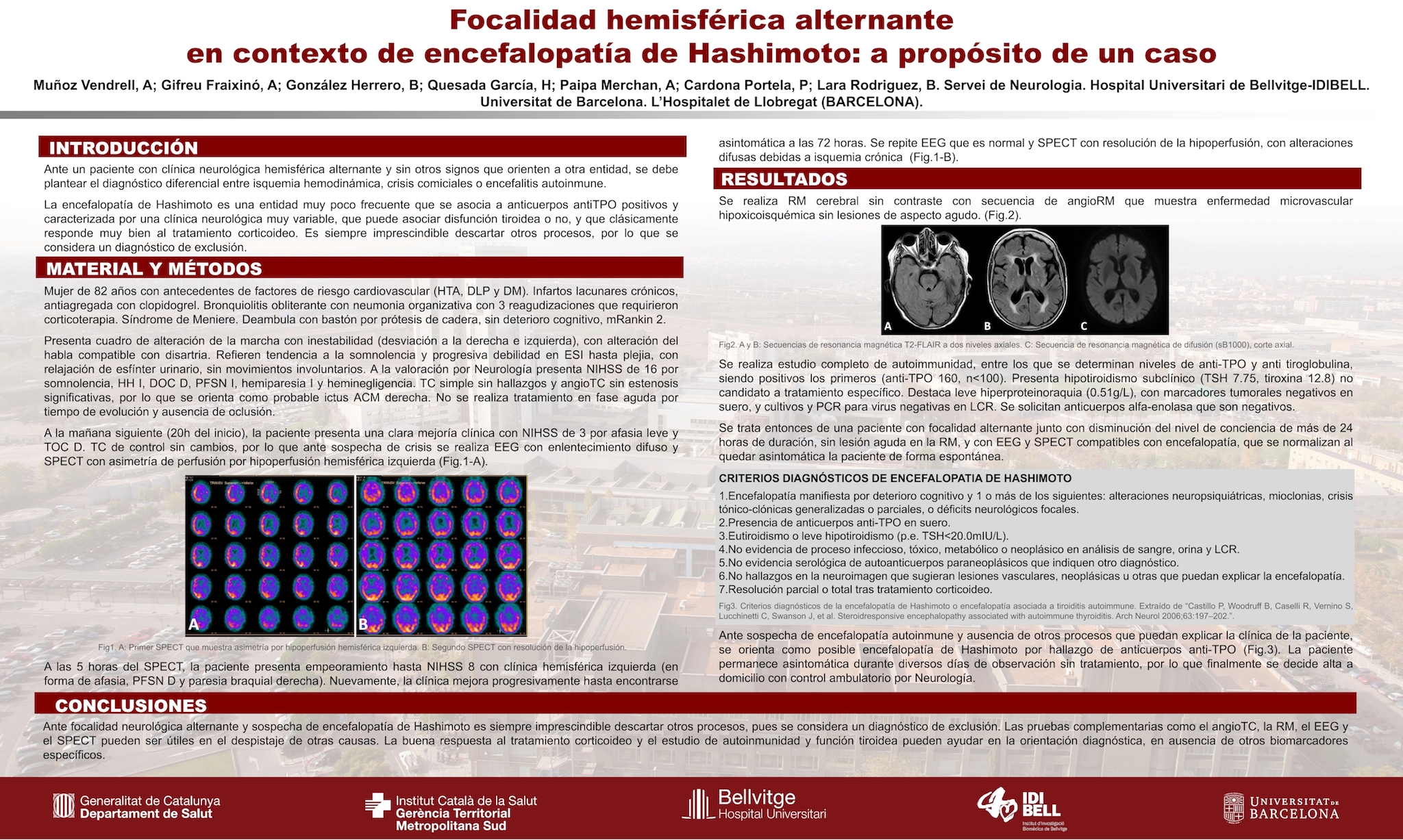 Focalidad hemisférica alternante en contexto de encefalopatía de Hashimoto: a propósito de un caso