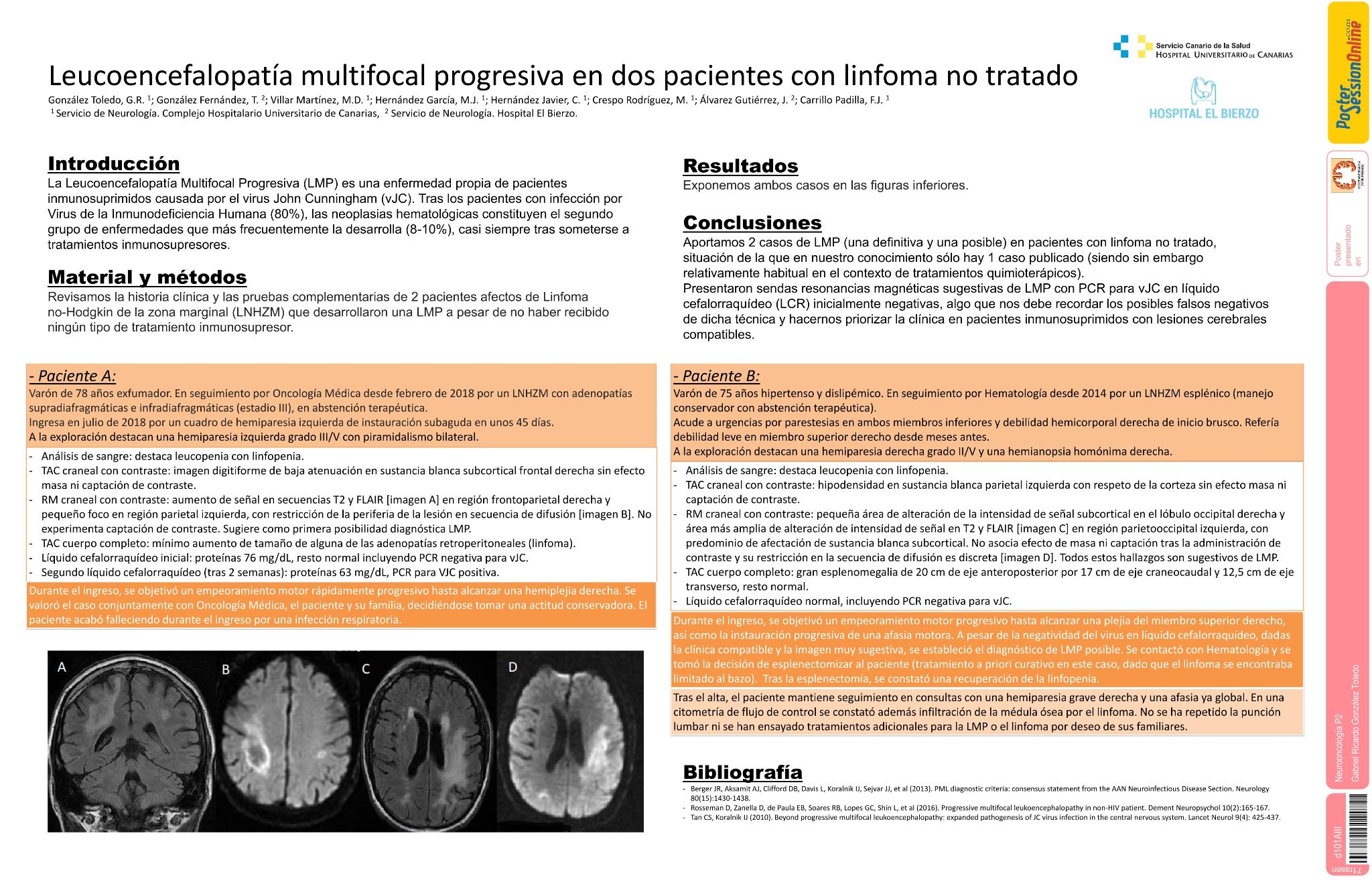Leucoencefalopatía multifocal progresiva en dos pacientes con linfoma no tratado