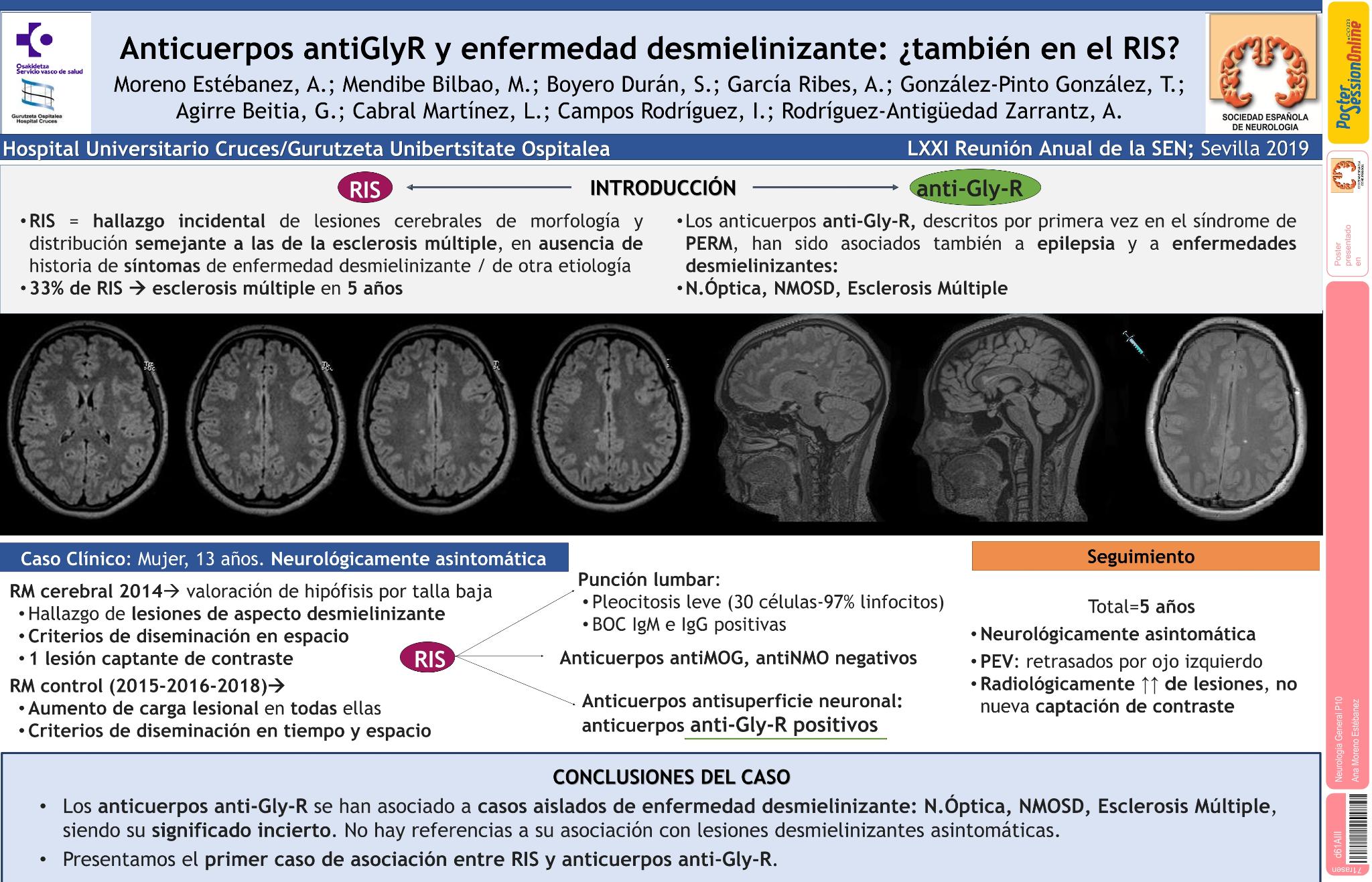 Anticuerpos antiGlyR y enfermedad desmielinizante: ¿también en el RIS?