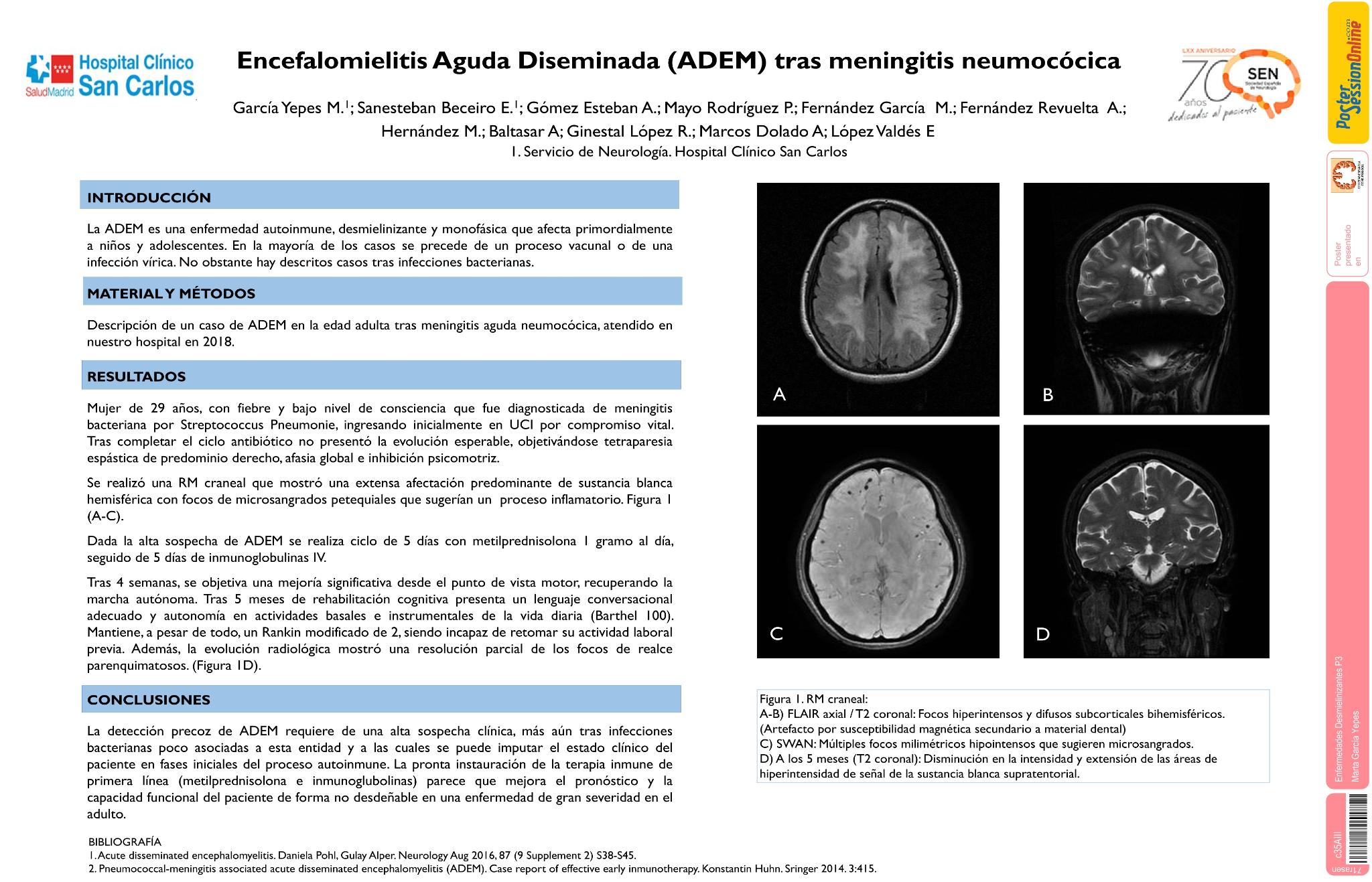 Encefalomielitis aguda diseminada (ADEM) tras meningitis neumocócica