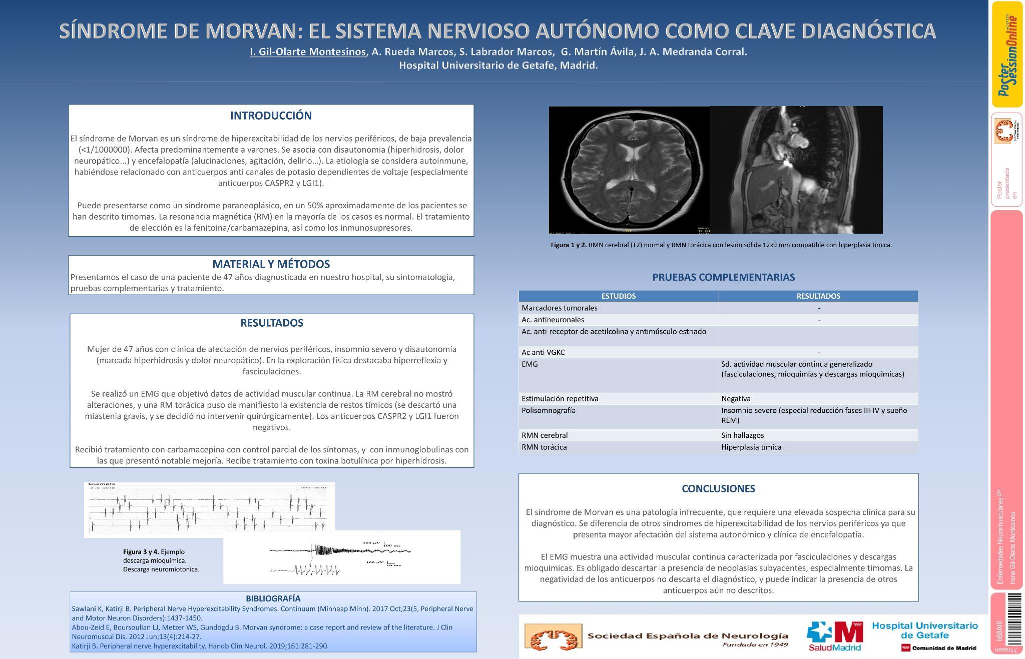 Síndrome de Morvan: el sistema nervioso autónomo como clave diagnóstica