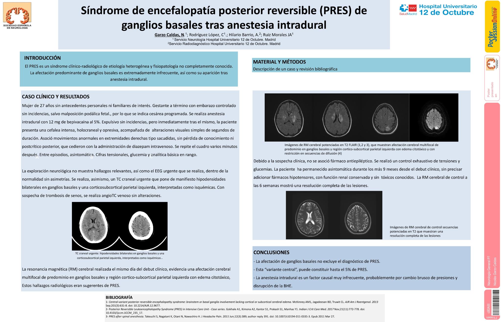 Síndrome de encefalopatía posterior reversible (PRES) de ganglios basales tras anestesia intradural