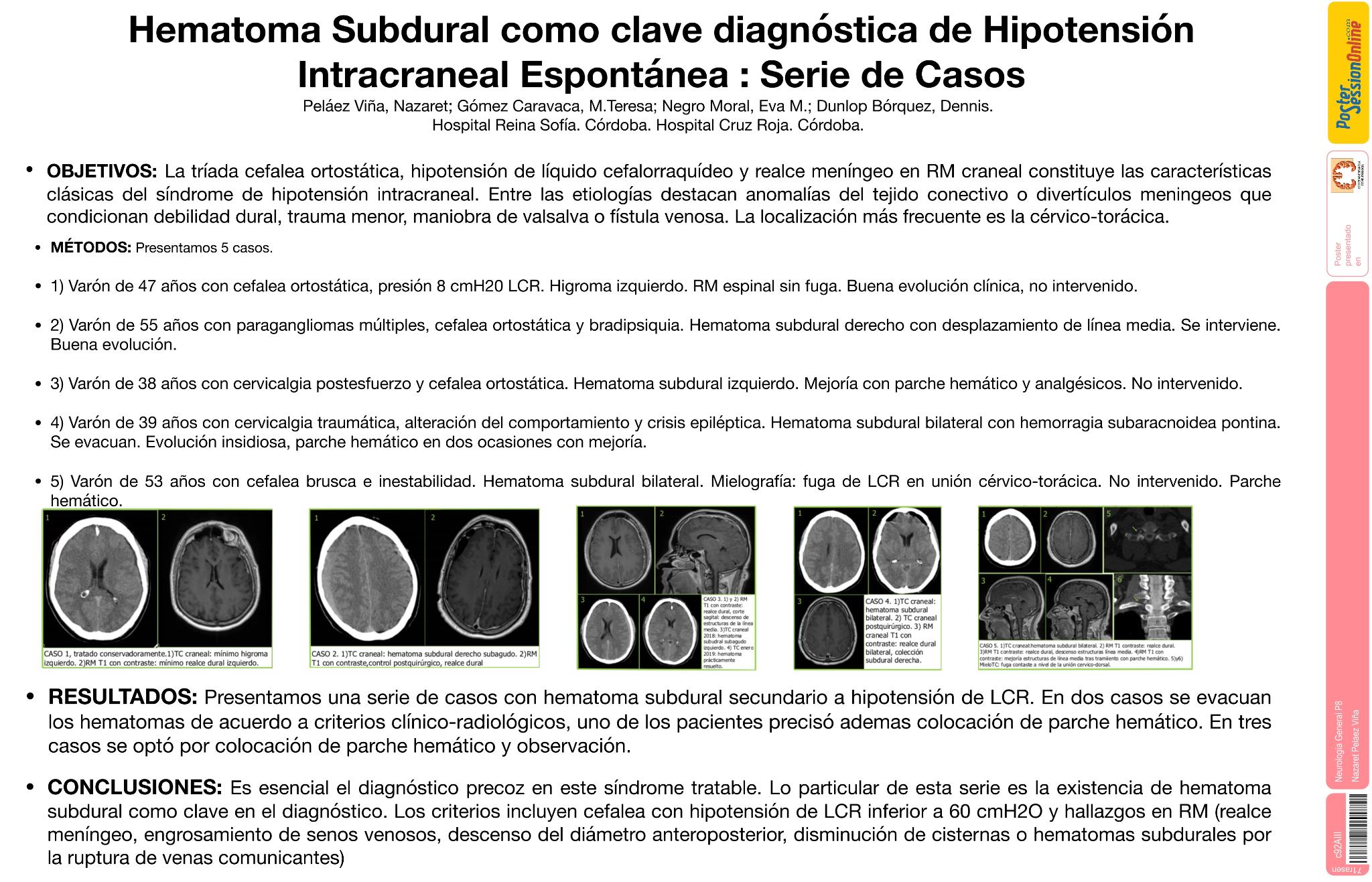 Hematoma Subdural como clave diagnóstica de Hipotensión intracraneal espontánea: serie de casos