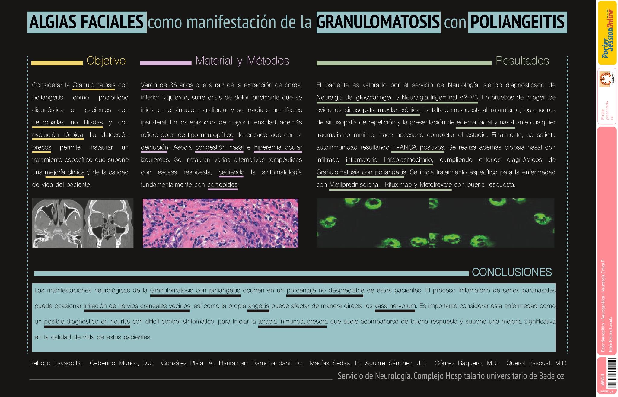 Algias faciales como manifestación de la granulomatosis con poliangeítis