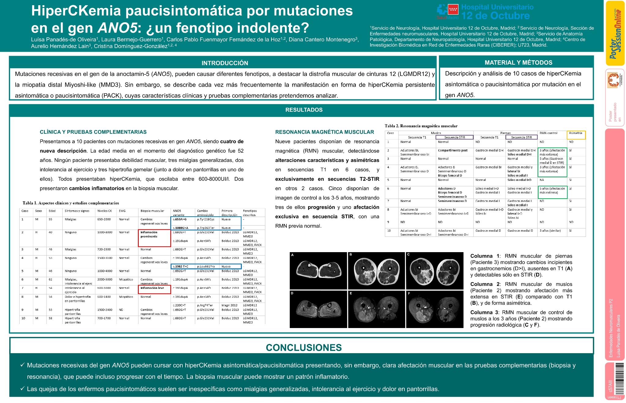 HiperCKemia paucisintomática por mutaciones en el gen ANO5: ¿un fenotipo indolente?