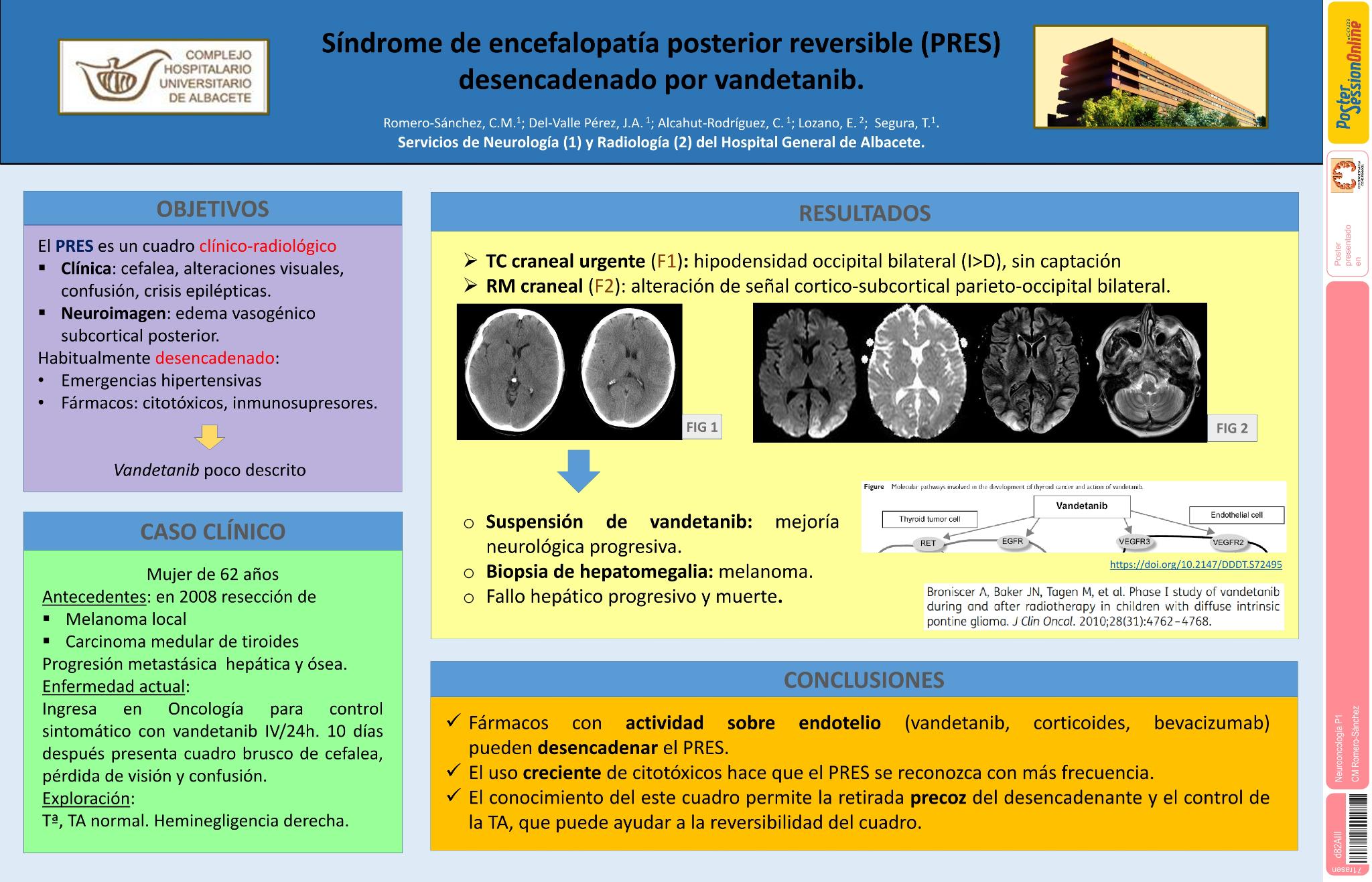 Síndrome de encefalopatía posterior reversible (PRES) desencadenado por vandetanib