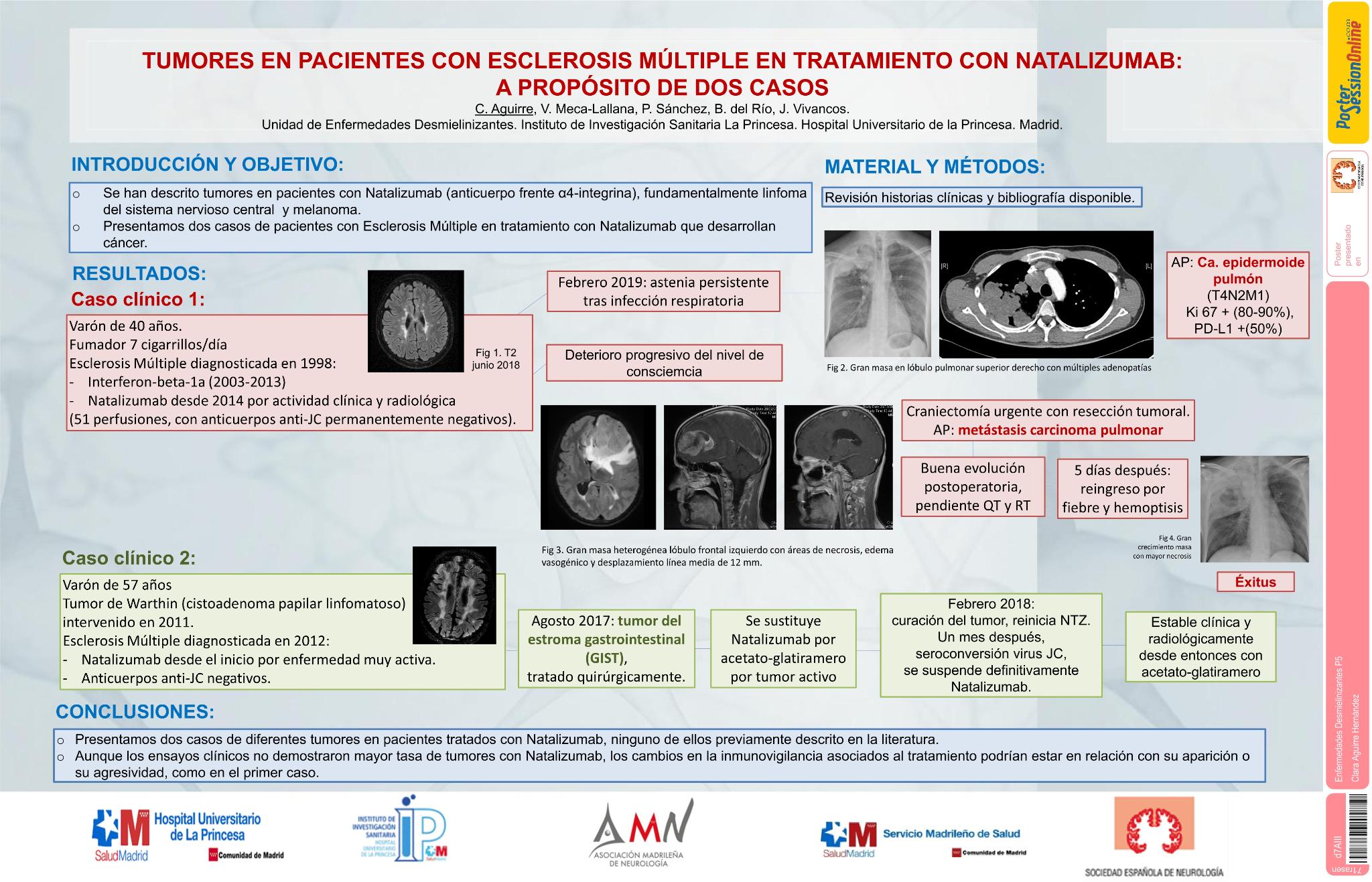 Tumores en pacientes con Esclerosis Múltiple en tratamiento con Natalizumab:  A propósito de dos casos