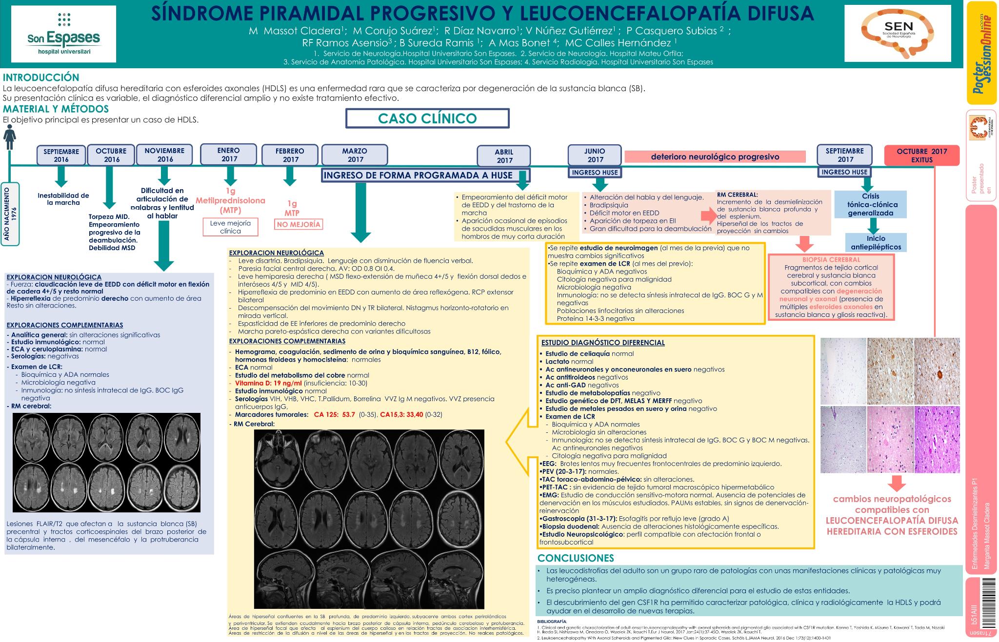 Síndrome piramidal progresivo y leucoencefalopatía difusa