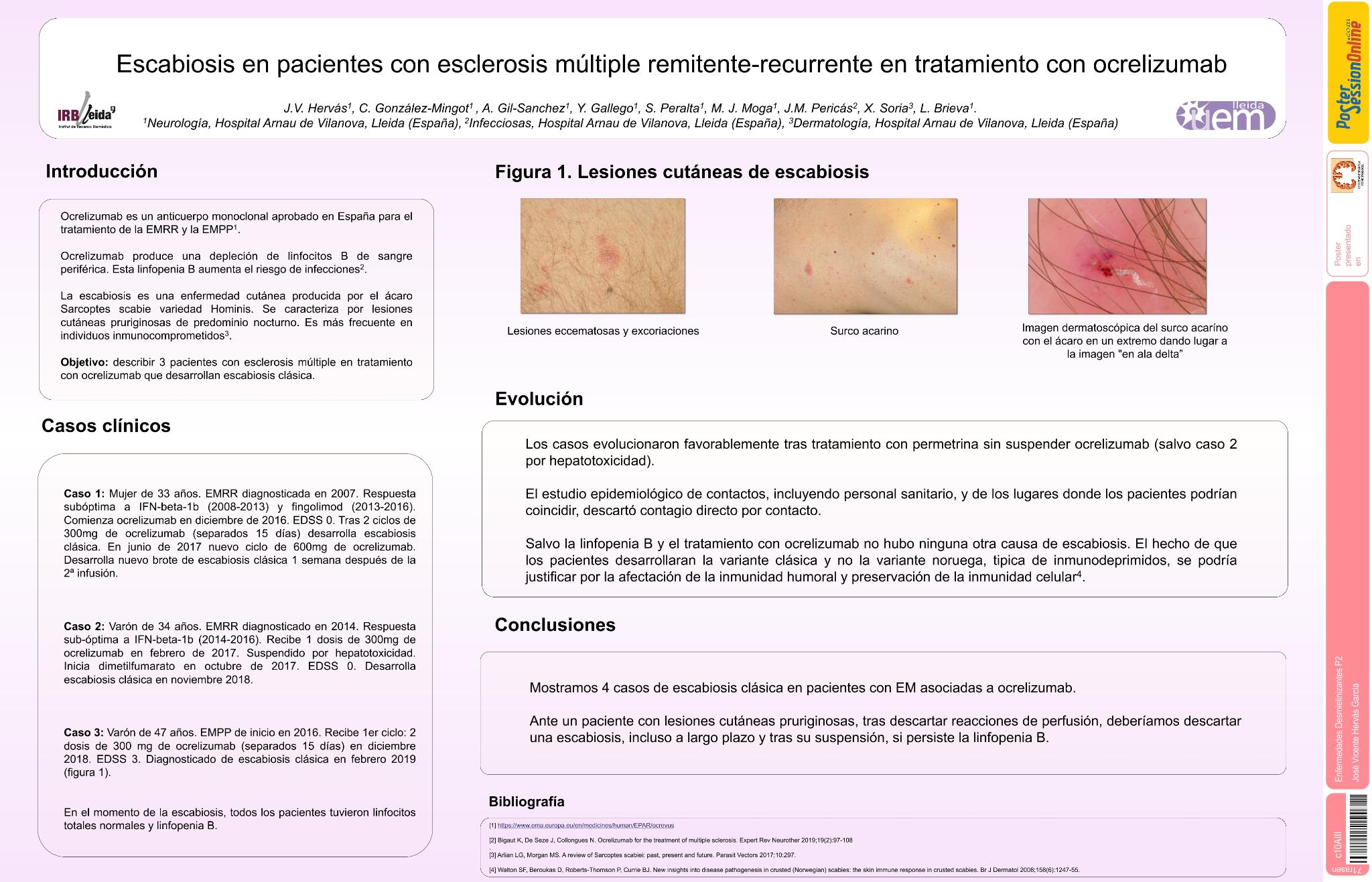 Escabiosis y ocrelizumab