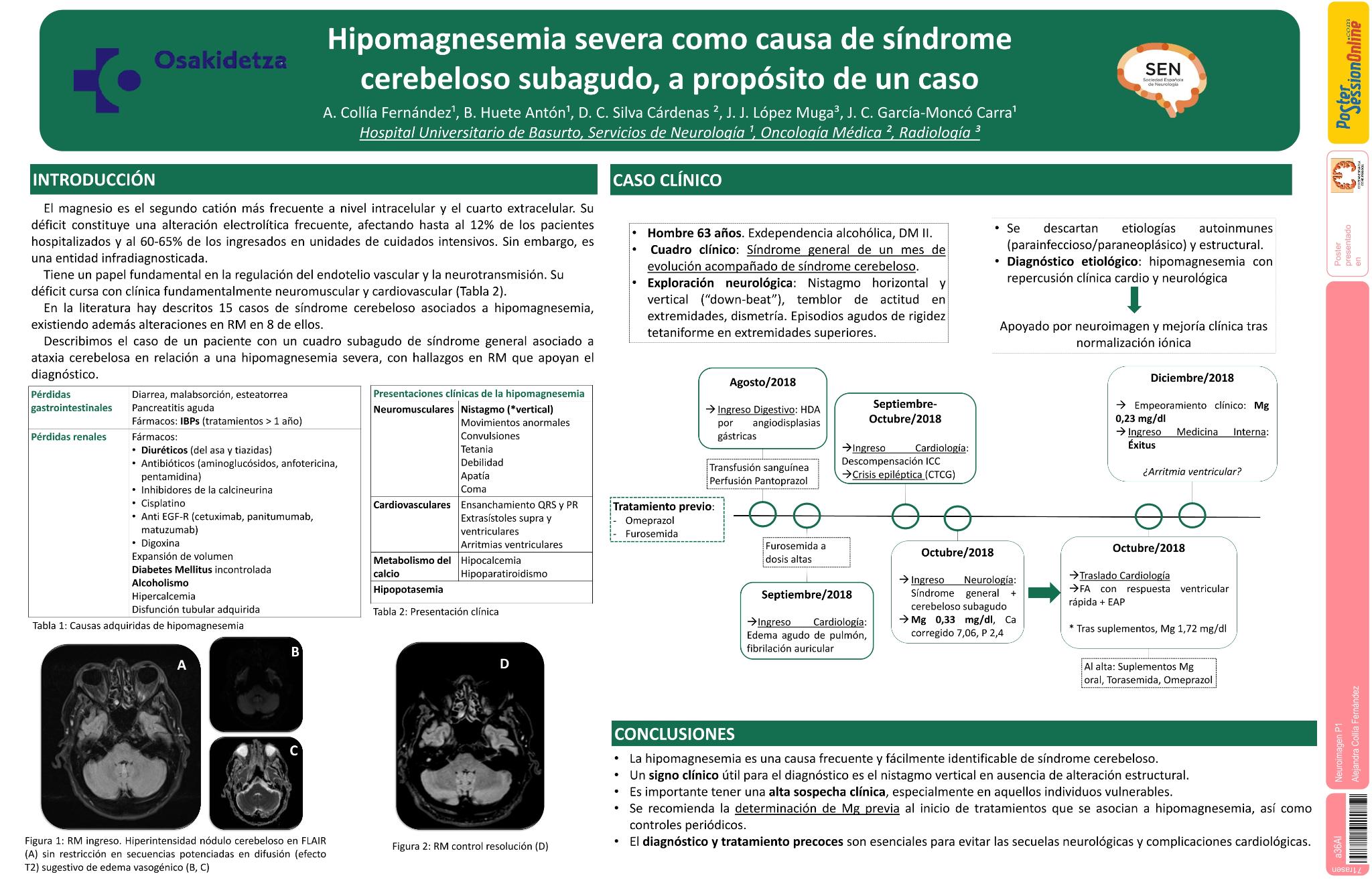 Hipomagnesemia severa como causa de síndrome cerebeloso subagudo, a propósito de un caso