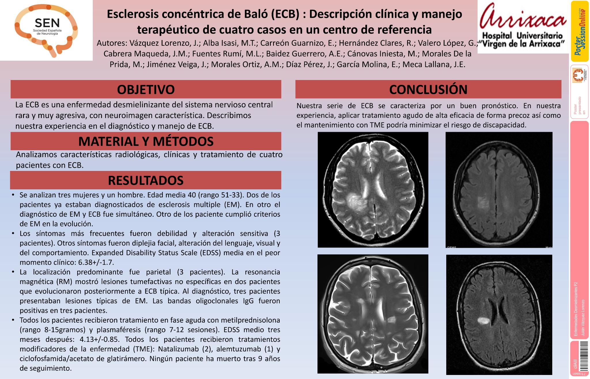 Esclerosis concéntrica de Baló (ECB) : Descripción clínica y manejo terapeútico de cuatro casos en un centro de referencia