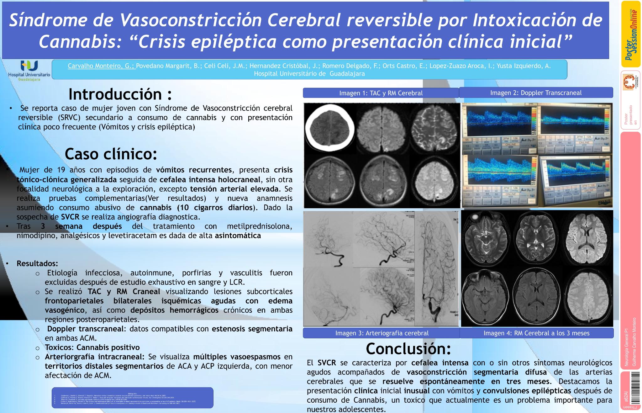 Síndrome de Vasoconstricción Cerebral reversible por Intoxicación de Cannabis: Crisis epiléptica como presentación clínica inicial