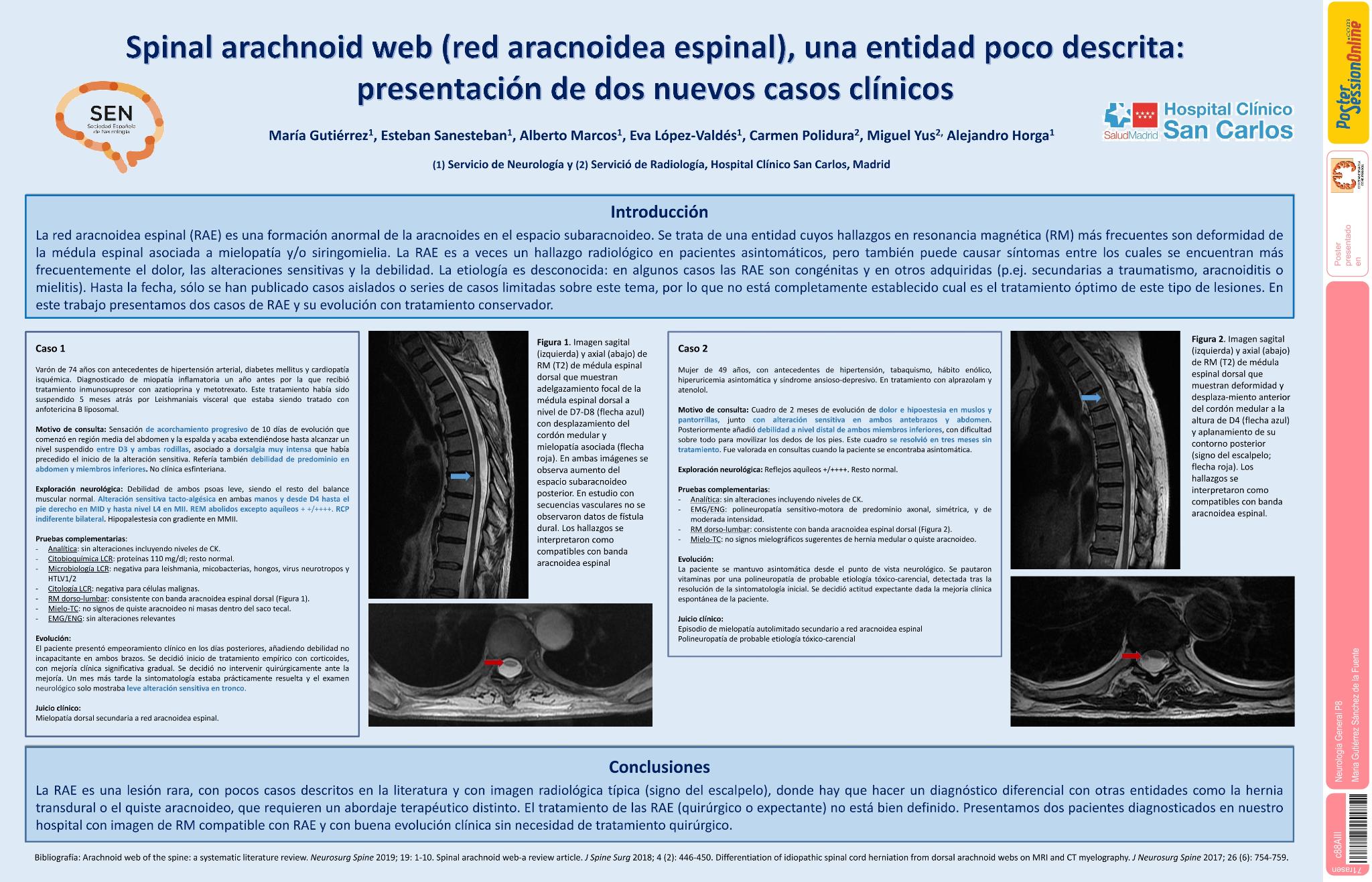 Espinal arachnoid web (red aracnoidea espinal), una entidad poco descrita: presentación de 2 nuevos casos clínicos