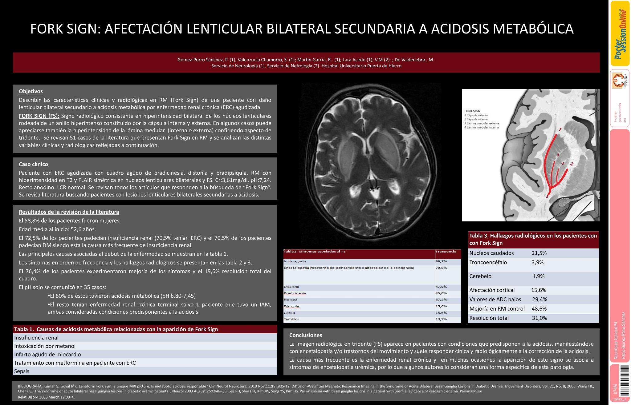 Fork Sign: daño de núcleos lenticulares bilaterales secundario a acidosis metabólica