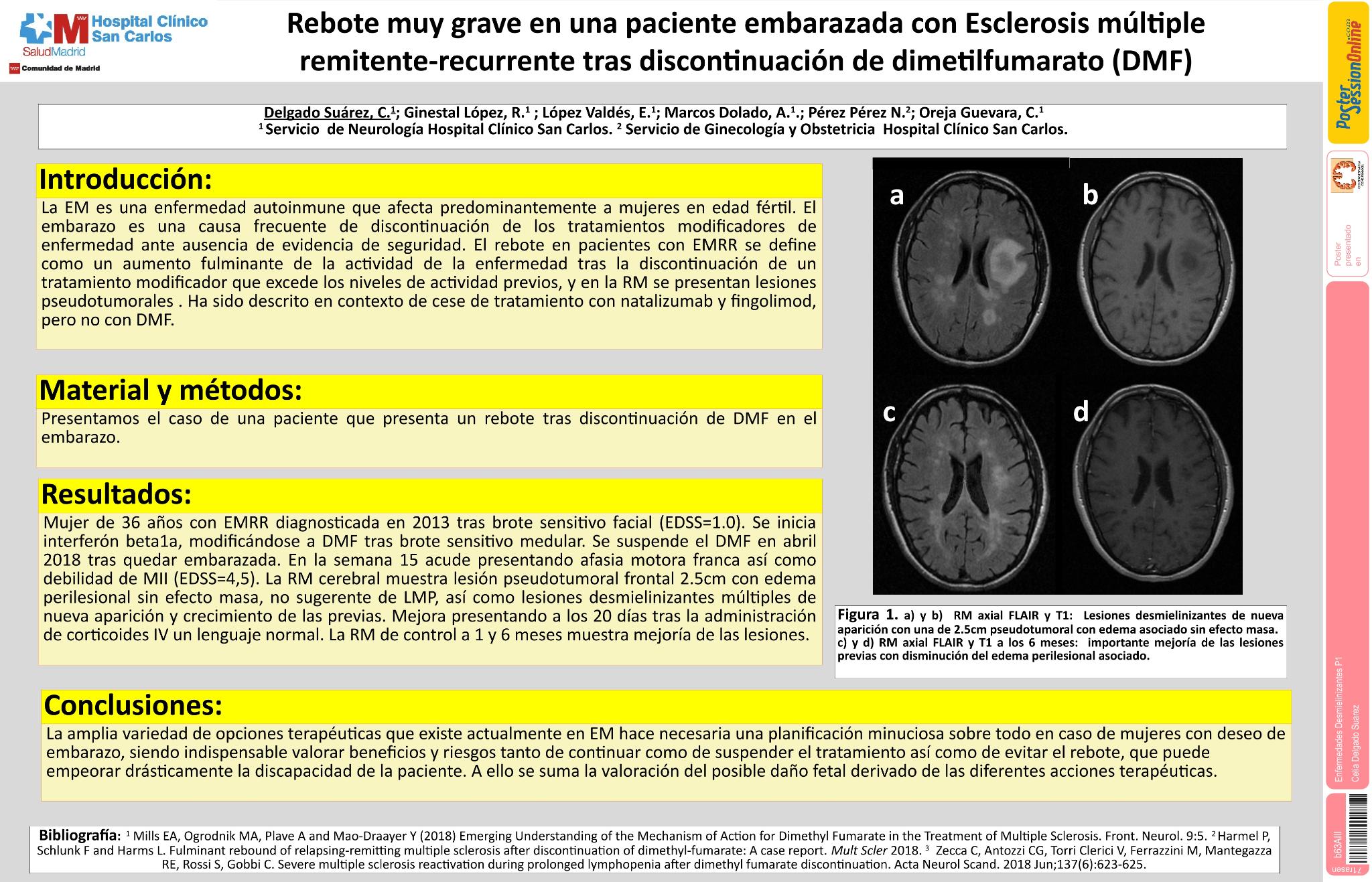 Grave Rebound en una paciente embarazada con Esclerosis múltiple remitente-recurrente tras discontinuación de dimetilfumarato (DMF)