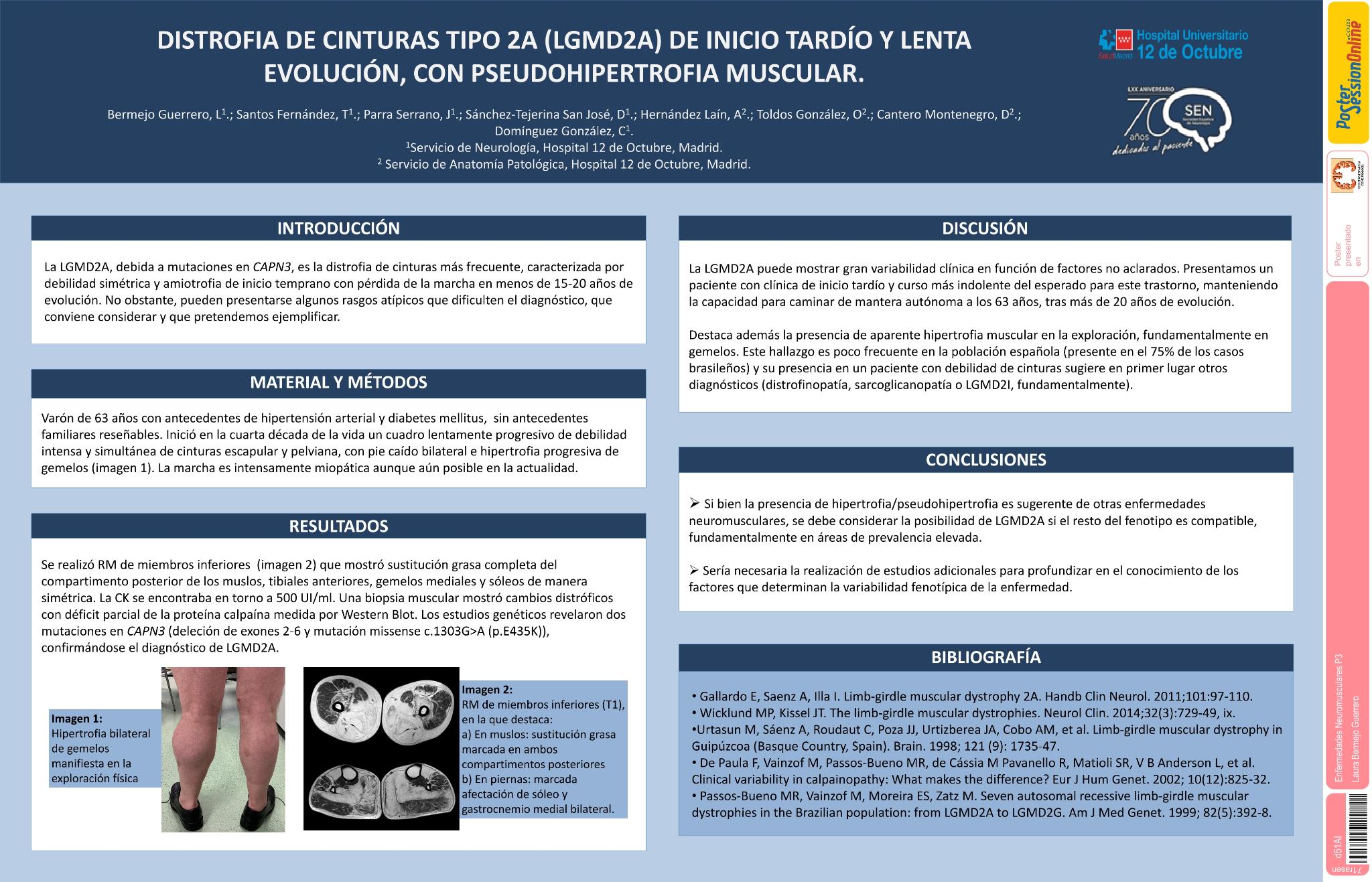 Distrofia de cinturas tipo 2A (LGMD2A) de inicio tardío y lenta evolución, con pseudohipertrofia muscular