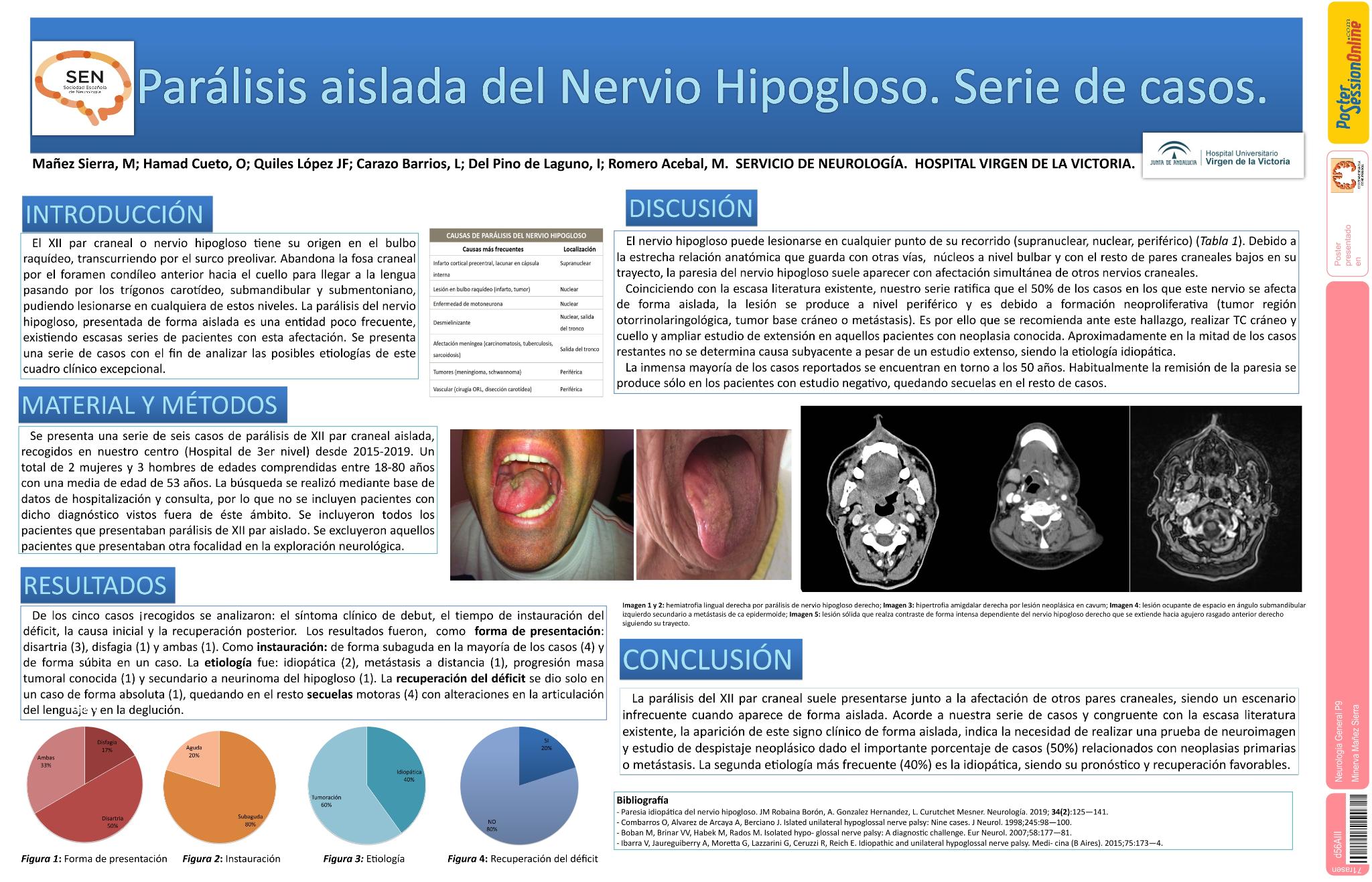 Paralisis del nervio hipogloso de forma aislada, serie de casos