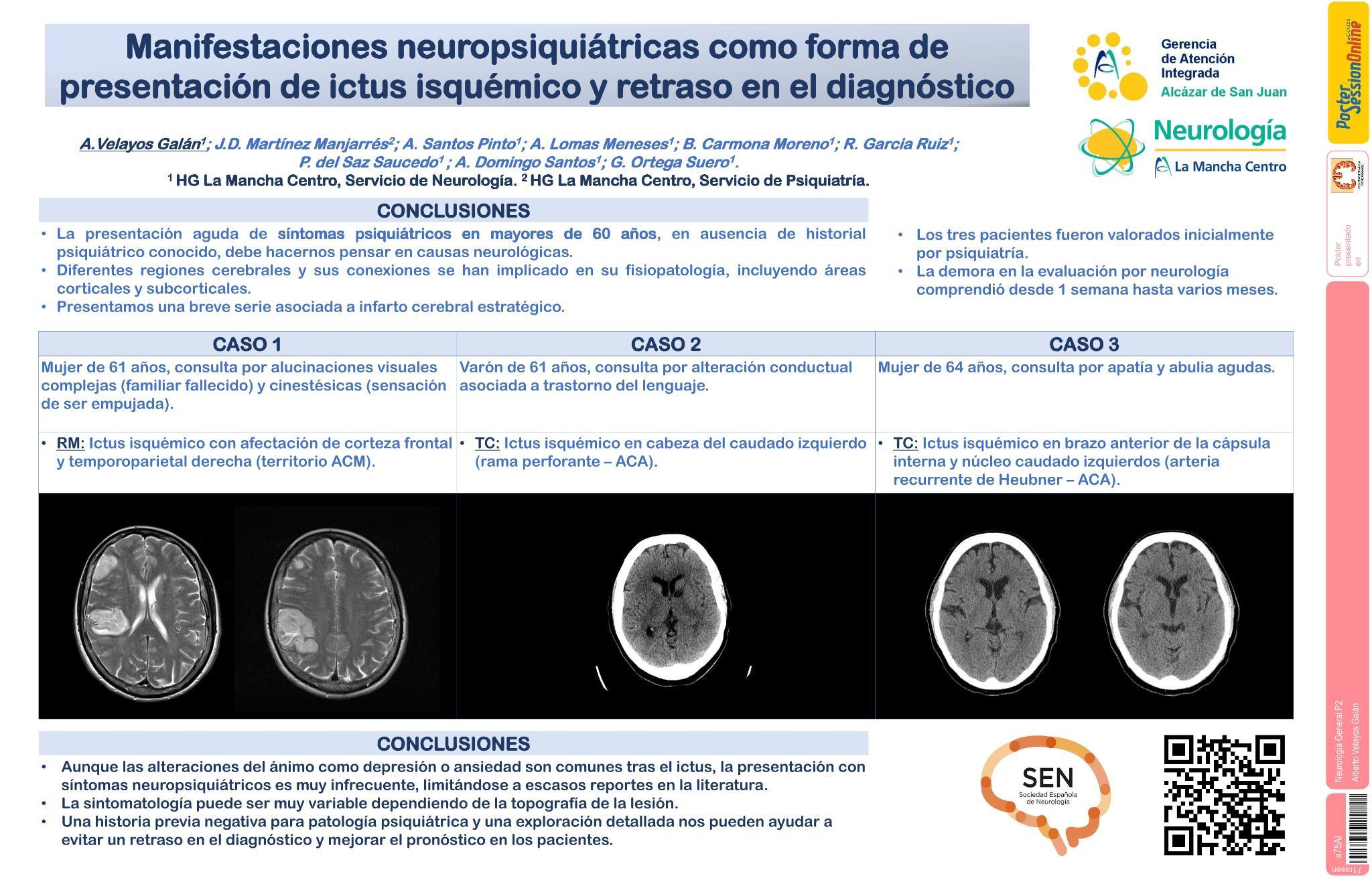 Manifestaciones neuropsiquiátricas como forma de presentación de ictus isquémico y retraso en el diagnóstico