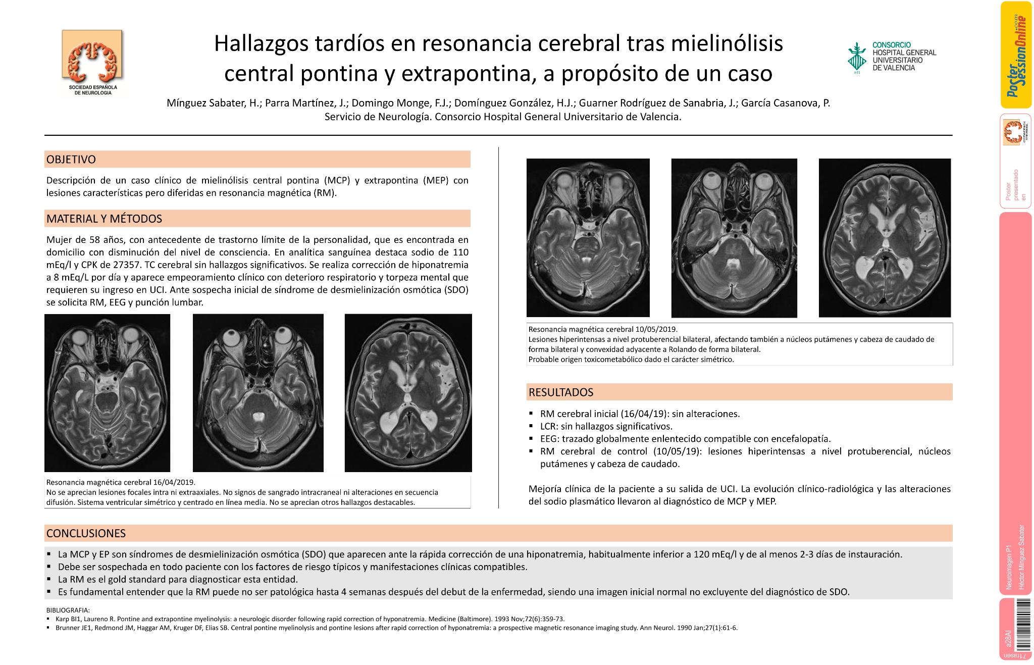 Hallazgos tardíos en resonancia cerebral tras mielinólisis central pontina y extrapontina, a propósito de un caso