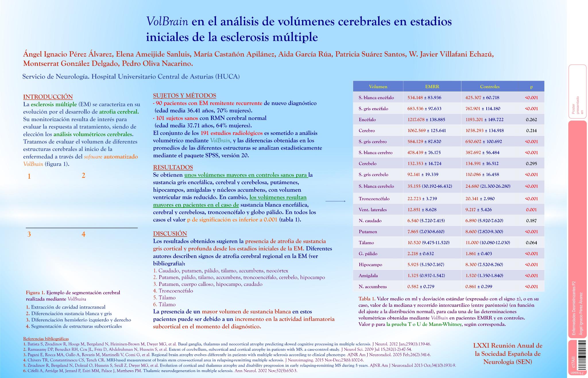 VolBrain en el análisis de volúmenes cerebrales en estadios iniciales de la esclerosis múltiple