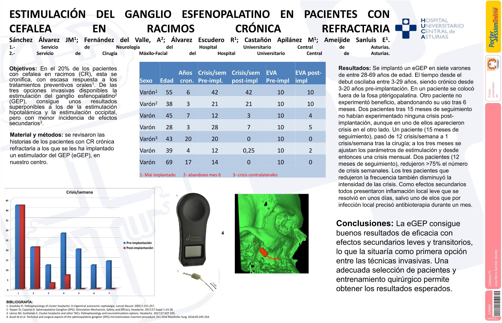 Estimulación del ganglio esfenopalatino en pacientes con cefalea en racimos crónica refractaria