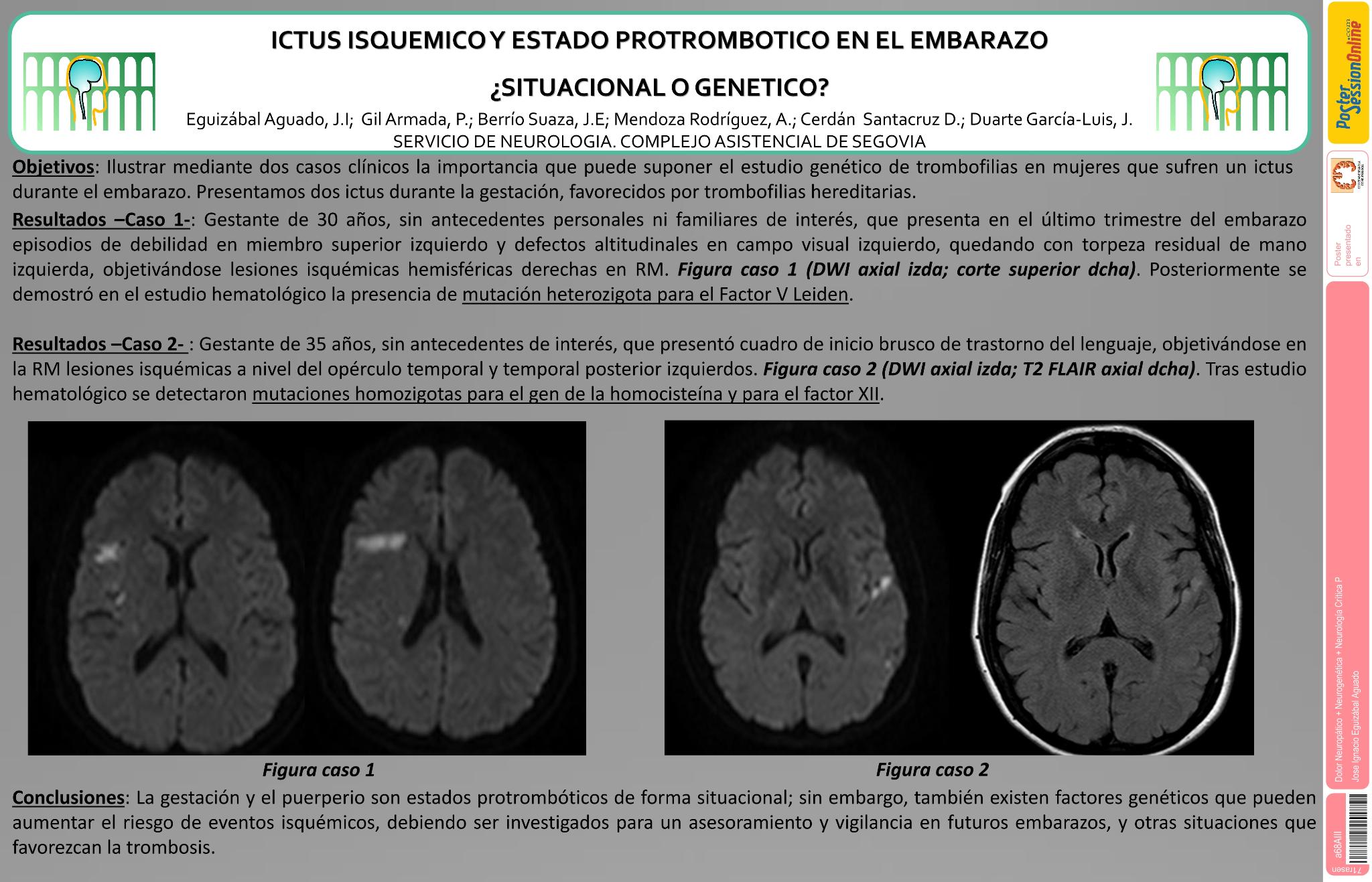 Ictus isquémico y estado protrombótico en el embarazo. ¿Situacional o genético?