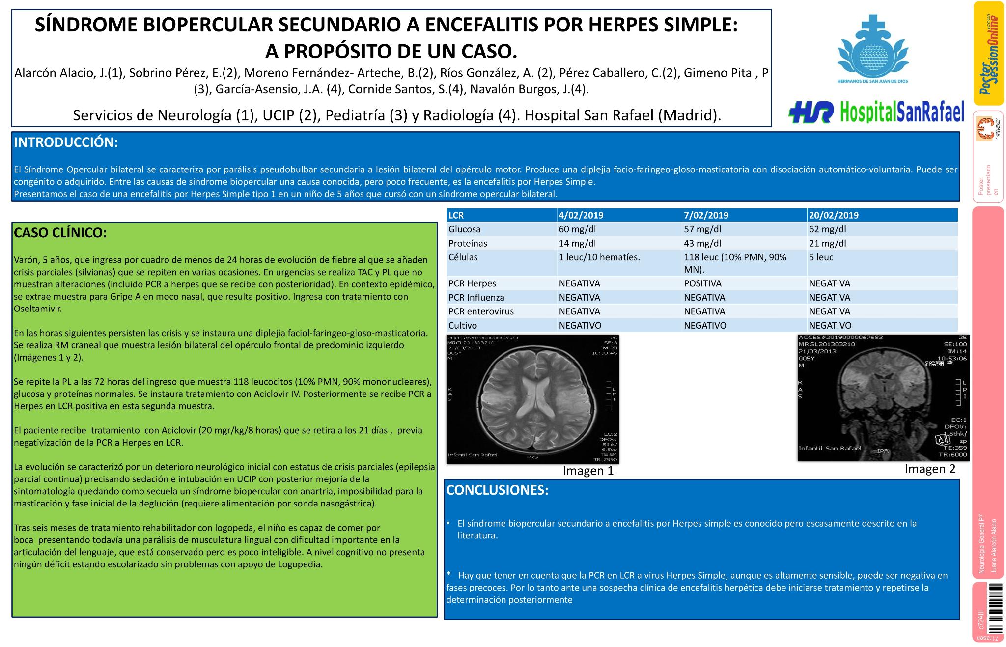 Síndrome biopercular secundario a Encefalitis por Herpes Simple