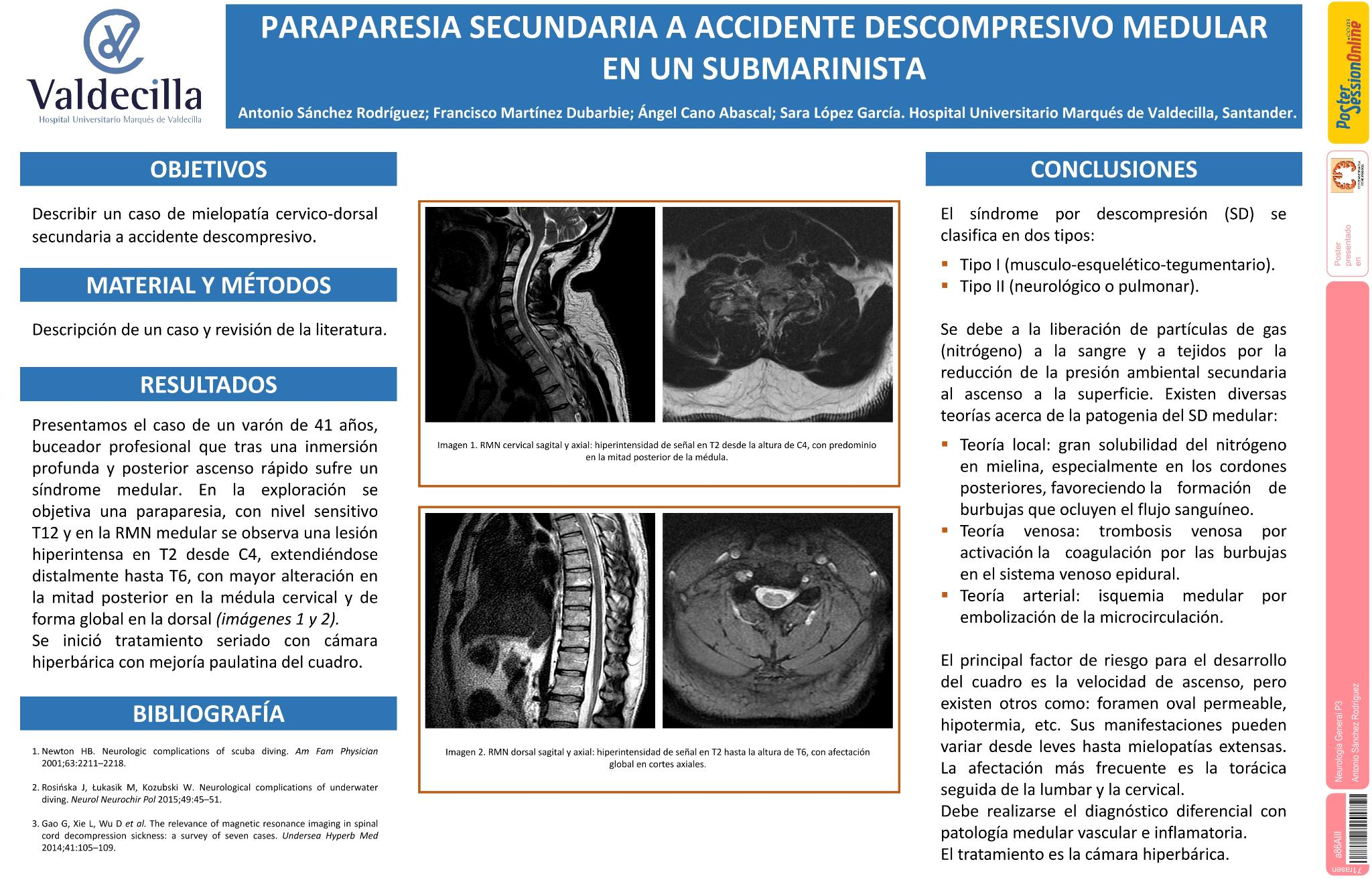 Paraparesia secundaria a accidente descompresivo medular en un submarinista. Accidente descompresivo medular en un submarinista