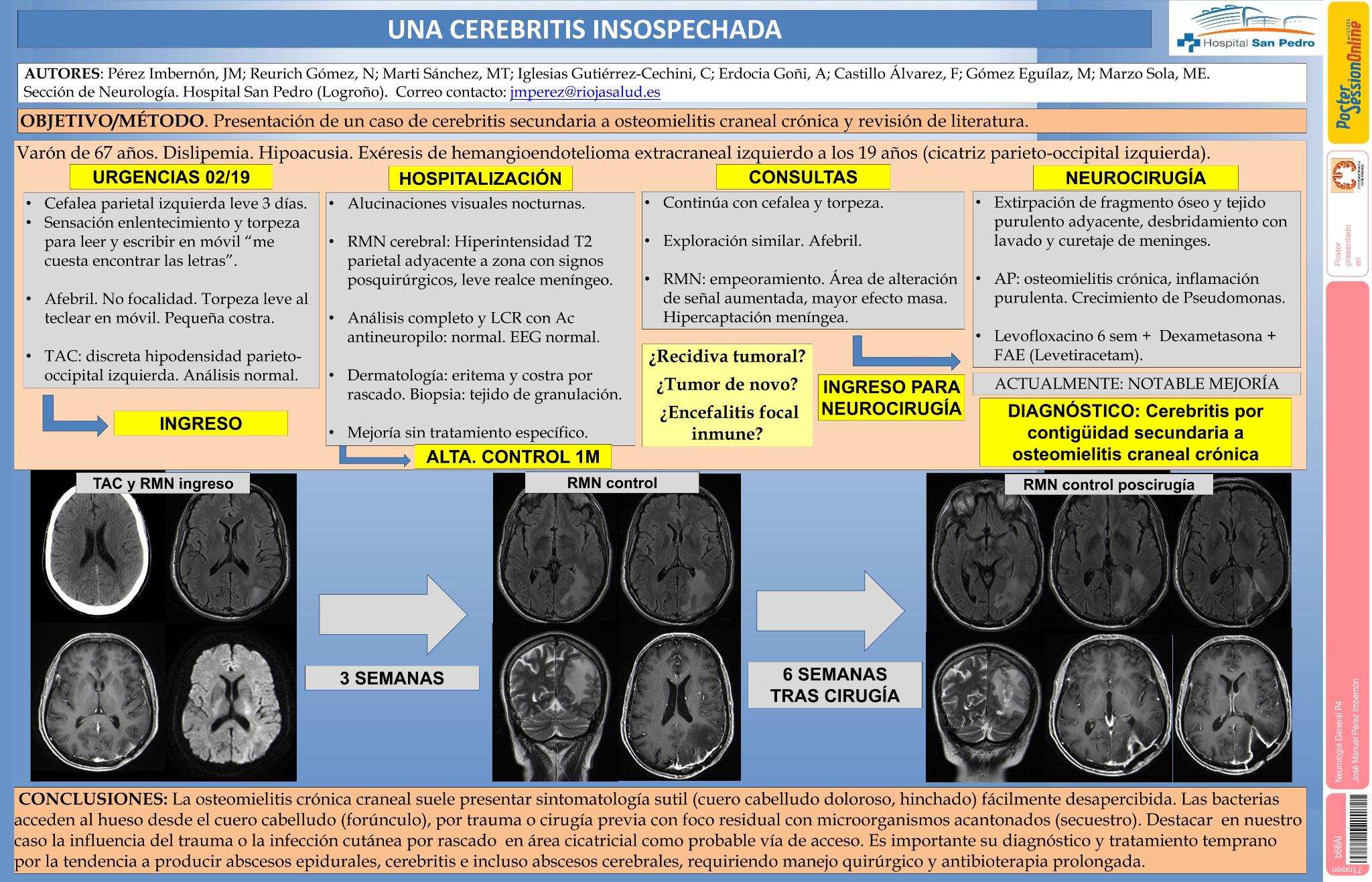 Un caso de cerebritis focal de causa insospechada