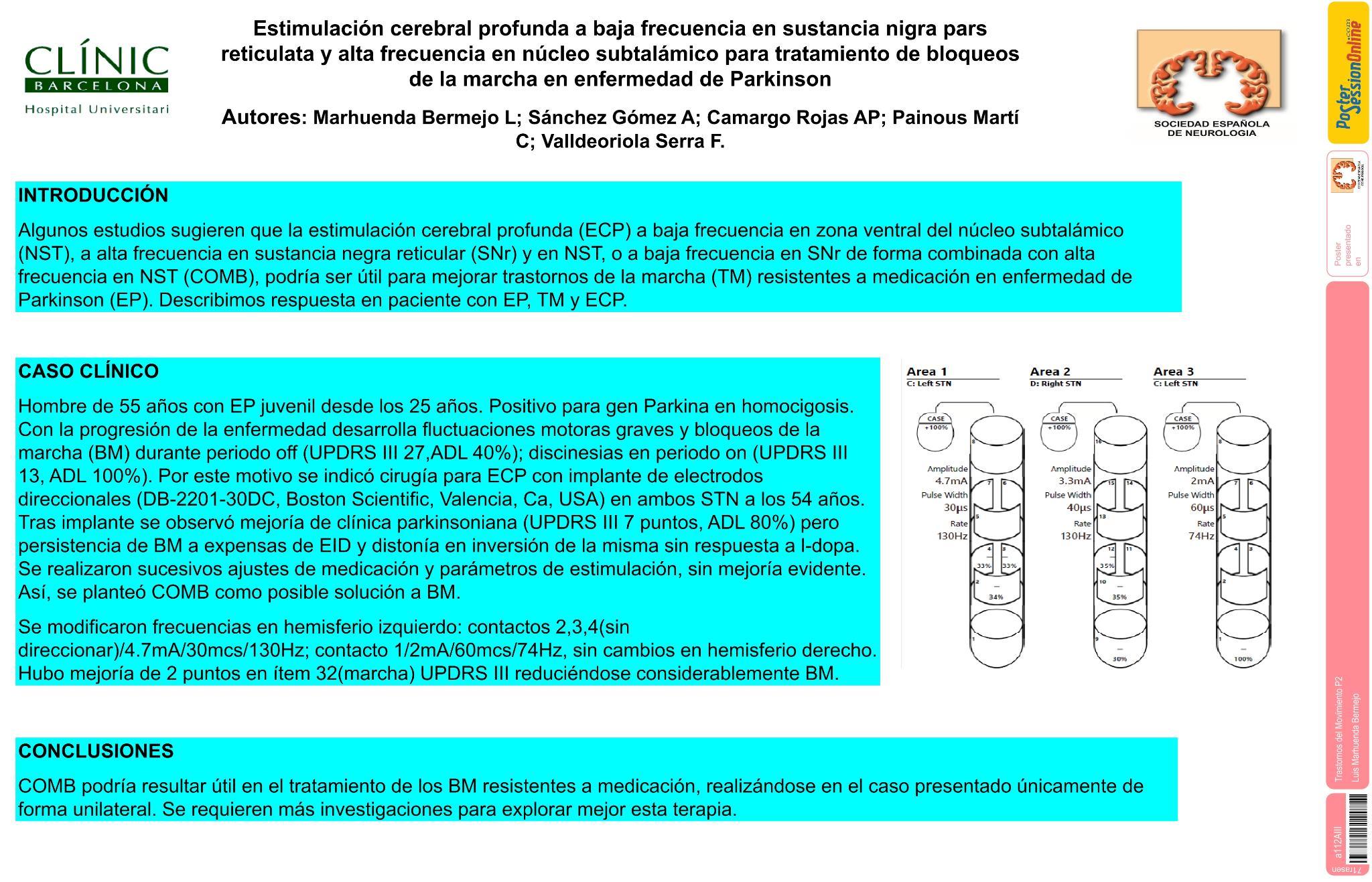 Estimulación cerebral profunda a baja frecuencia en sustancia nigra pars reticulata y alta frecuencia en núcleo subtalámico para tratamiento de bloqueos de la marcha en enfermedad de Parkinson