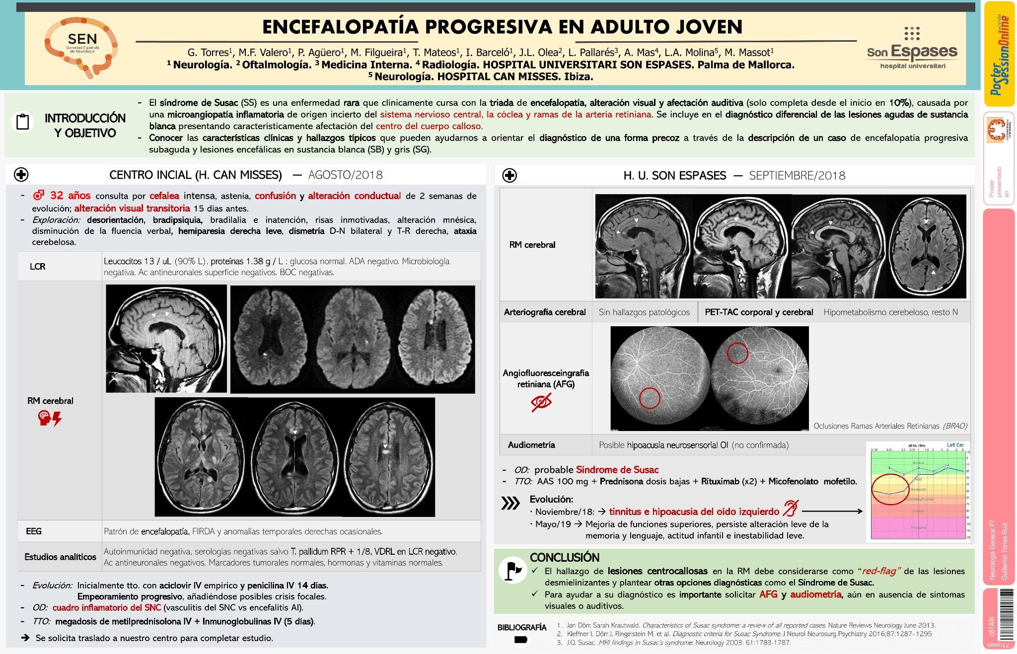 Encefalopatía progresiva en adulto joven