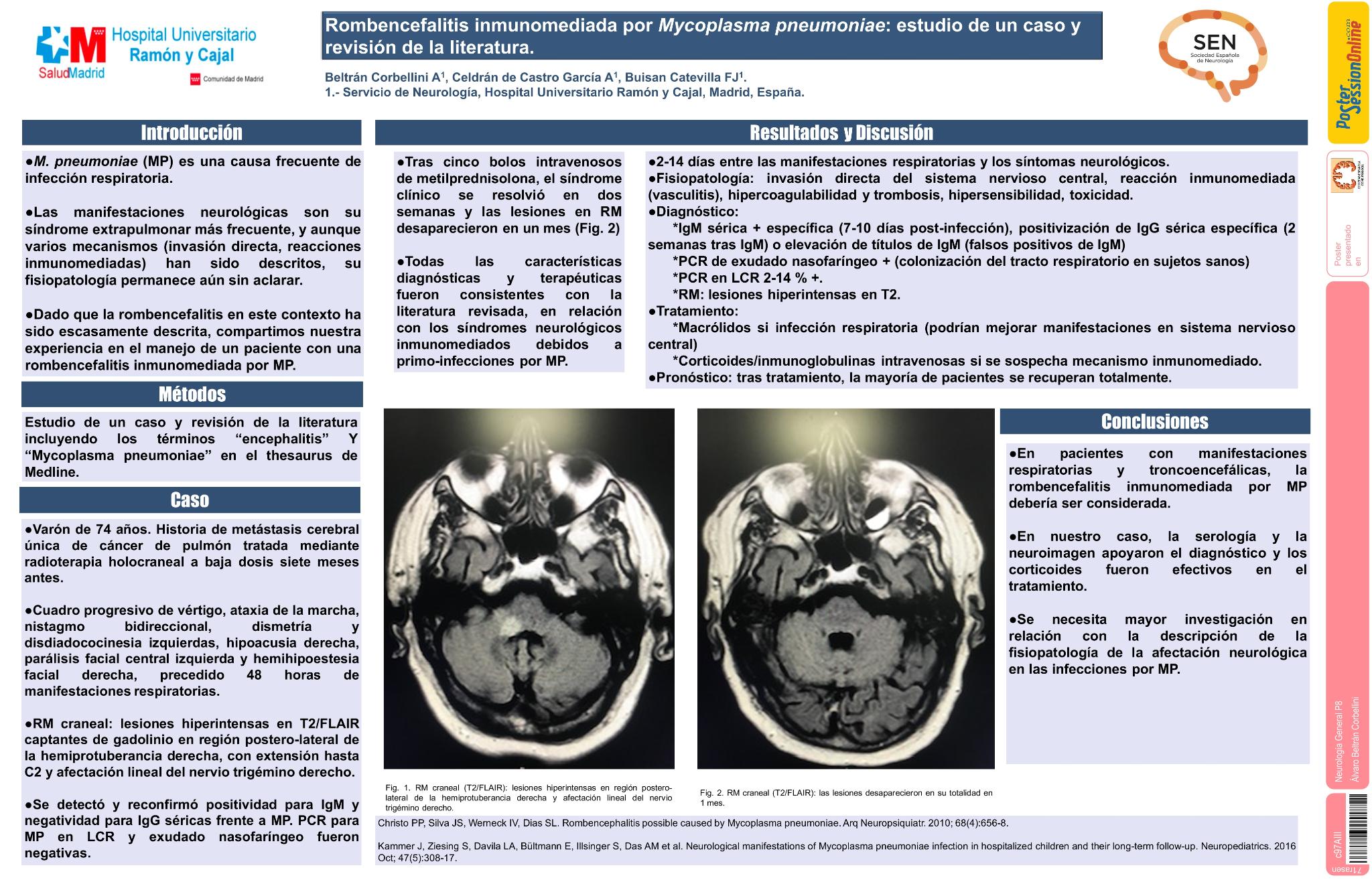 Rombencefalitis inmunomediada post-infección por Mycoplasma pneumoniae: estudio de un caso y revisión de la literatura