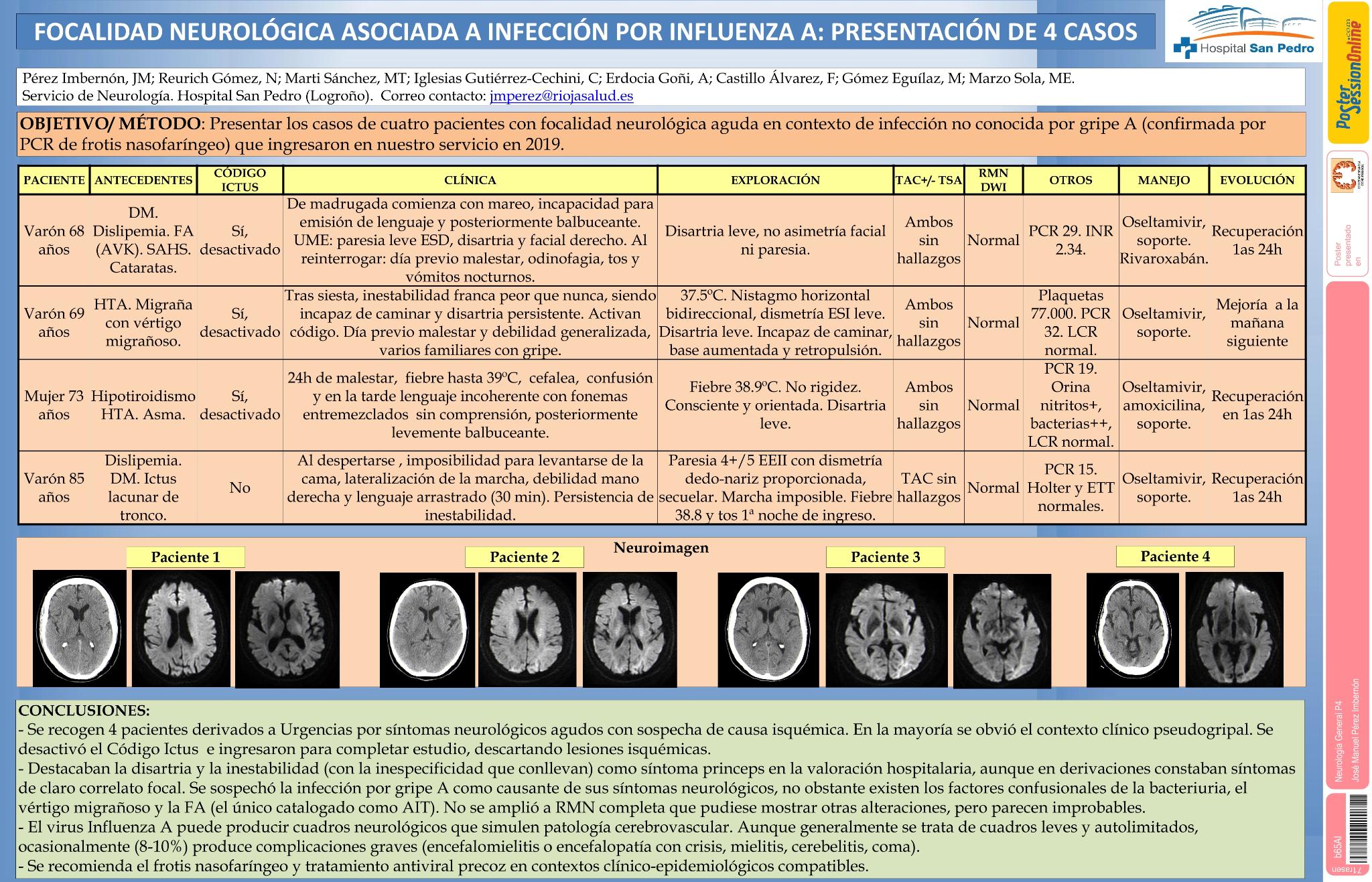 Focalidad neurológica aguda asociada a infección por influenza A. Presentación de 4 casos.