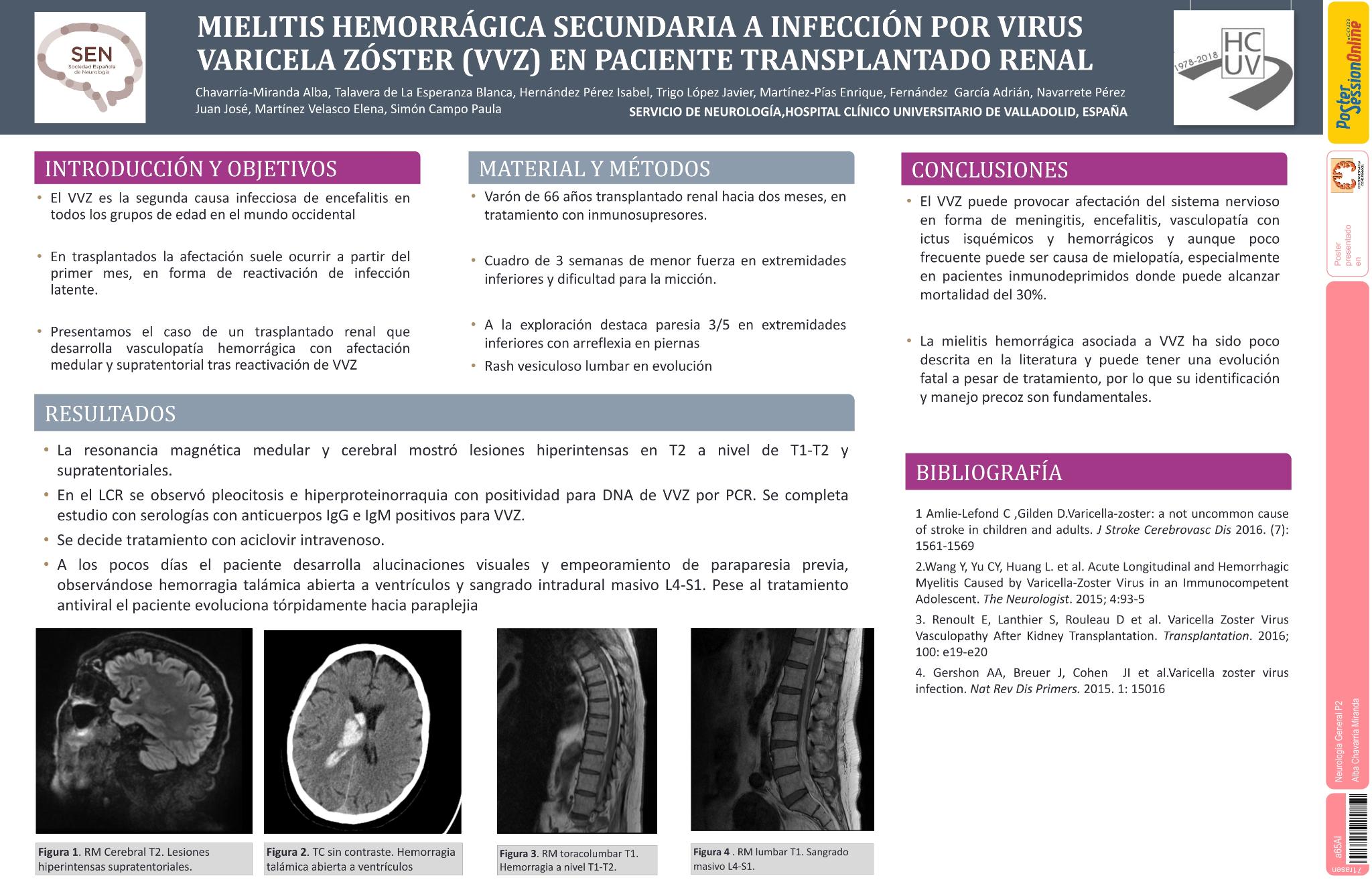 Mielitis hemorrágica secundaria a infección por virus varicela zóster (VVZ) en paciente trasplantado renal